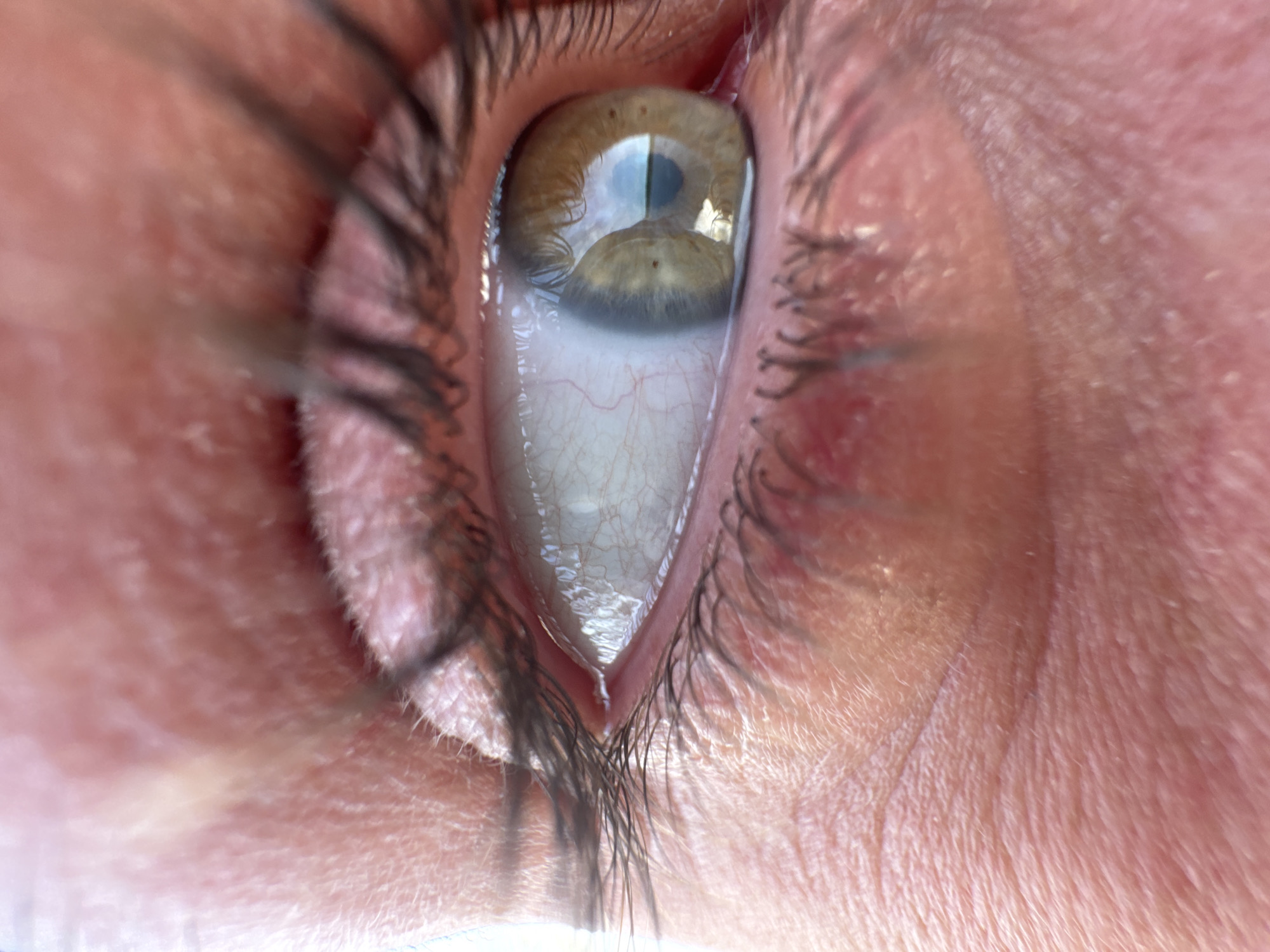A close-up image features a human eye with light-colored, possibly hazel, iris. The eye is surrounded by eyelashes, and the skin around it is visible with texture details and fine lines. The sclera (white part) shows visible blood vessels. There is a clear reflection on the surface of the iris, indicating a light source. There is no evidence to place the image in Timiryazevskii S/S, Russia.