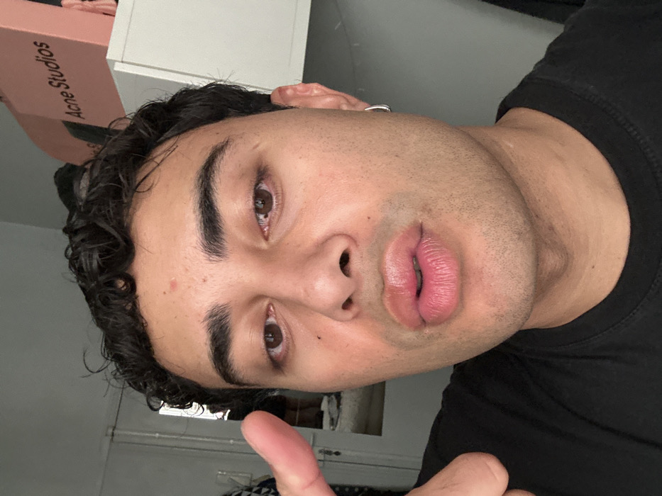 A close-up, indoor portrait captures a male subject with dark, curly hair and a light brown complexion, looking directly at the camera. He wears a black t-shirt and a silver hoop earring in his right ear. His lips are full and slightly pursed. Notable facial features include a small red blemish on his forehead and a small dark mole below his left eye; both eyes appear bloodshot. His left index finger is partially visible in the upper left of the frame, raised and pointing towards his temple area. The background elements include a light-colored wall or doorframe and a partial reflection in a mirror on the left. On the right, a white shelf holds a pink-toned box or bag displaying the white text "Acne Studios" alongside other dark, indistinct items. The specific location within the city of Paris, France, cannot be definitively determined from the visual information presented, though the presence of an "Acne Studios" branded item, a fashion label with a store in Paris, offers a circumstantial association.