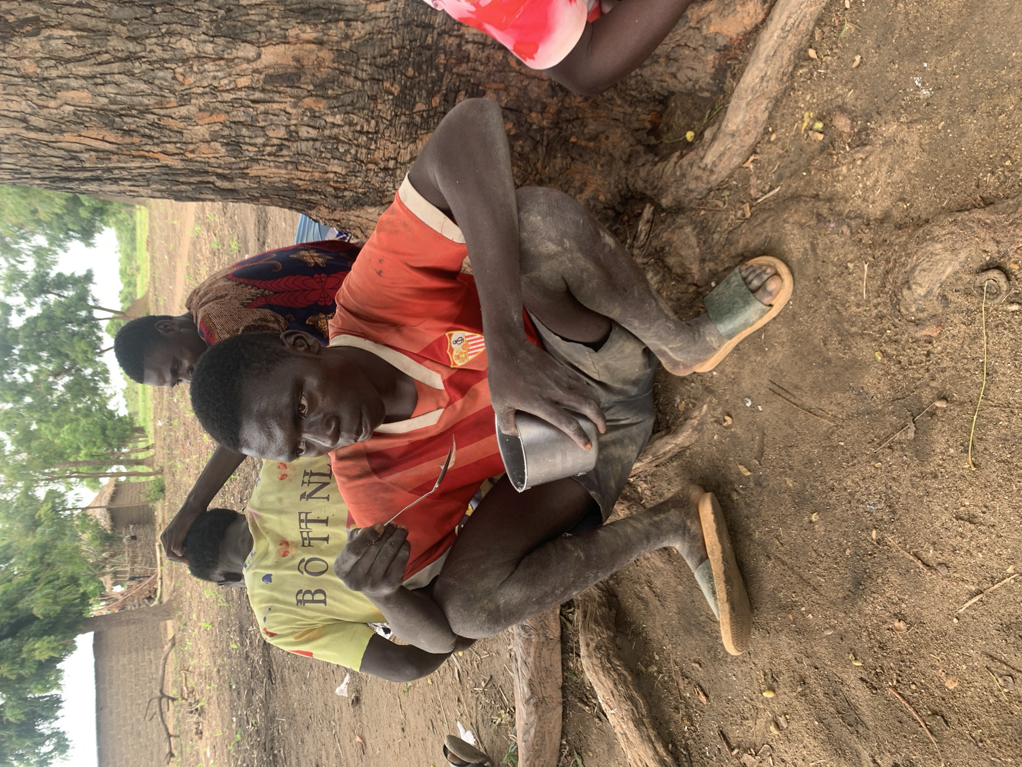 In Dull A, Nigeria, a group of individuals is gathered outdoors, near a large tree with visible roots. The ground is dirt and scattered with dry leaves and twigs. In the foreground, a person wearing an orange and white striped shirt and dark shorts is seated on the ground, facing the viewer. They are holding a metal bowl in their left hand and a spoon in their right, appearing to be eating. Their legs are dirty, and they are wearing a light-colored sandal on their left foot. Behind them, another person in a yellow shirt with black lettering is seated, with their back to the camera, and their head being touched by a hand from another person in the background. A third person, partially visible in the background, is wearing a patterned, colorful fabric. Further behind, traditional mud-brick buildings with thatched roofs are visible amidst trees.