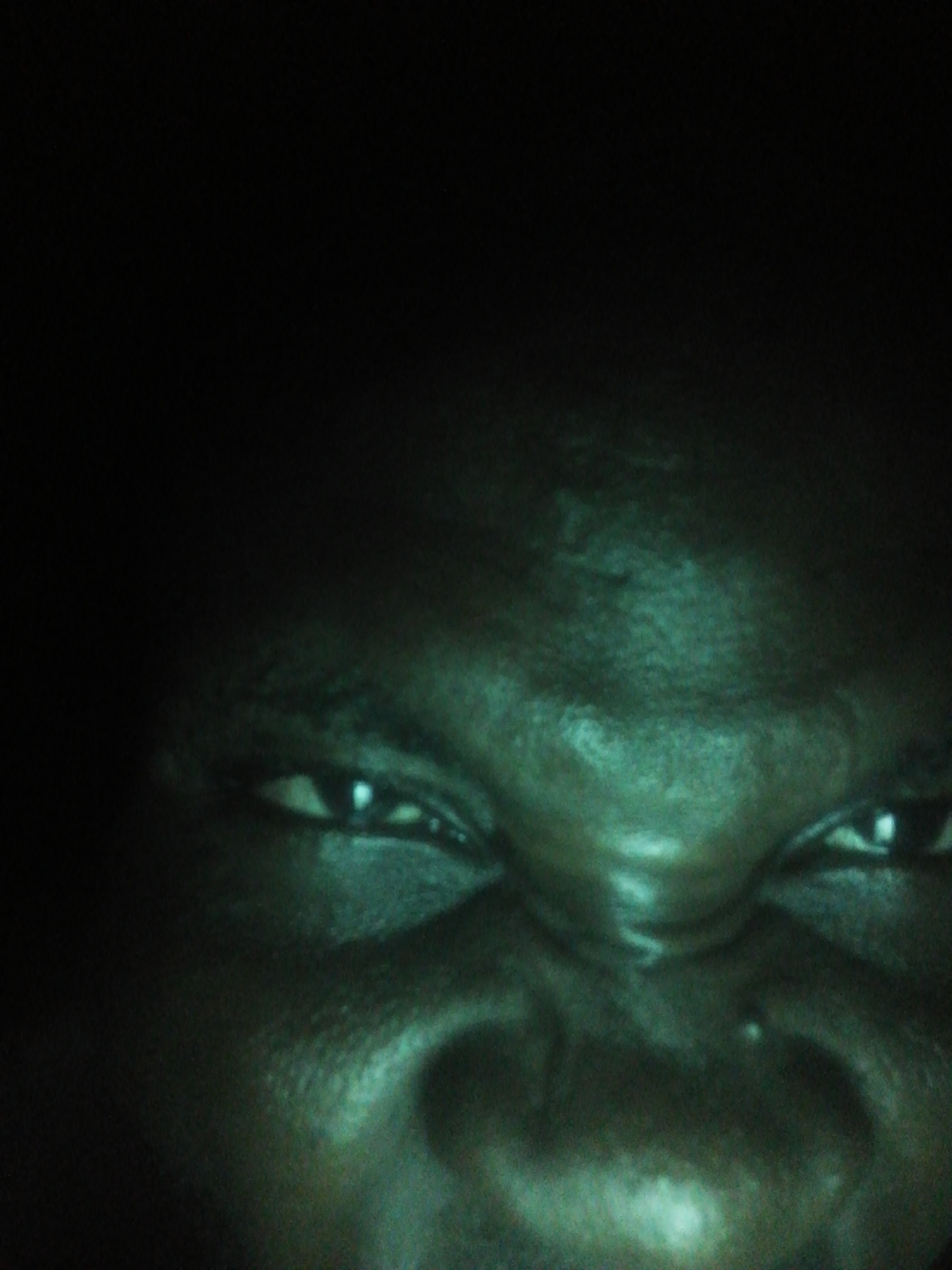 A close-up, low-light photograph depicts a portion of a person's face. Visible features include the nose, eyes, and part of the forehead. The skin appears to be dark-toned and textured. The environment is undiscernible due to the extreme close-up and darkness surrounding the subject. Location is unknown.