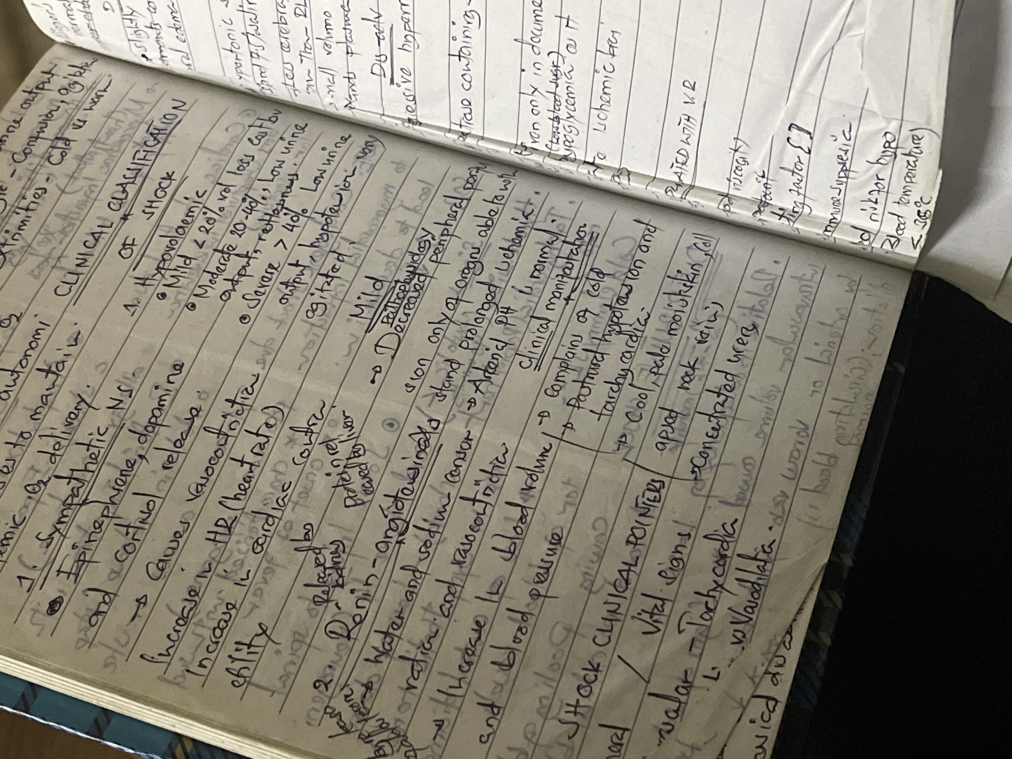 The image displays an open spiral-bound notebook filled with handwritten notes, possibly placed on top of another book or surface. The notes are predominantly in black ink on lined, off-white paper, suggesting academic study or record-keeping.
The primary subject of the notes is medical, specifically focusing on "CLINICAL CLASSIFICATION OF SHOCK." One section details "A. Hypovolaemic" shock, categorizing its severity:
* "Mild < 20% vol loss" with "normal output, restlessness."
* "Moderate 20-40%," characterized by "Low urine output, restlessness."
* "Severe > 40%," with "Low urine output, hypotension, very agitated."
Other sections describe physiological mechanisms, including the role of the "Sympathetic NS and cortinol release" (Epinephrine, dopamine leading to vasoconstriction, increased heart rate, and cardiac contractility) and the "Renin-angiotensin-aldosterone" system (water and sodium conservation, vasoconstriction, increased blood volume, and blood pressure).
"CLINICAL POINTERS" or "Vital Signs" for shock are also listed, including complaints of cold, postural hypotension, tachycardia, cool and pale moist skin, and concentrated urine output. Other visible terms include "Pathophysiology," "Immunosuppressive," and "Blood temperature < 35°C."
The notebook appears well-used, with some creased pages. The image is taken from a slightly overhead perspective, highlighting the detailed handwritten content.