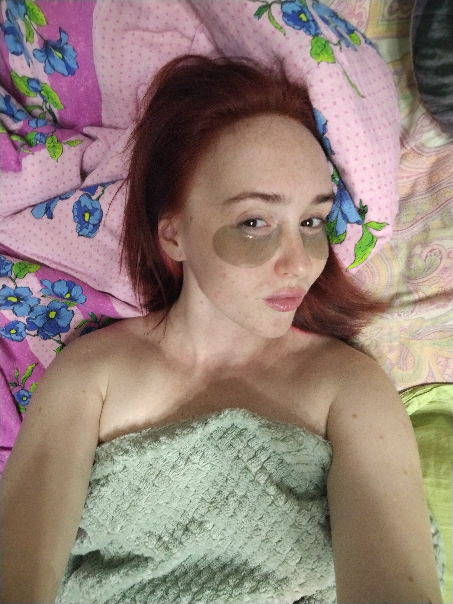 A fair-skinned woman with red hair and freckles lies in a bed, wearing eye patches. She is partially covered by a light green textured blanket. The bedding includes a pink pillow and floral-patterned sheets. The location is indiscernible.