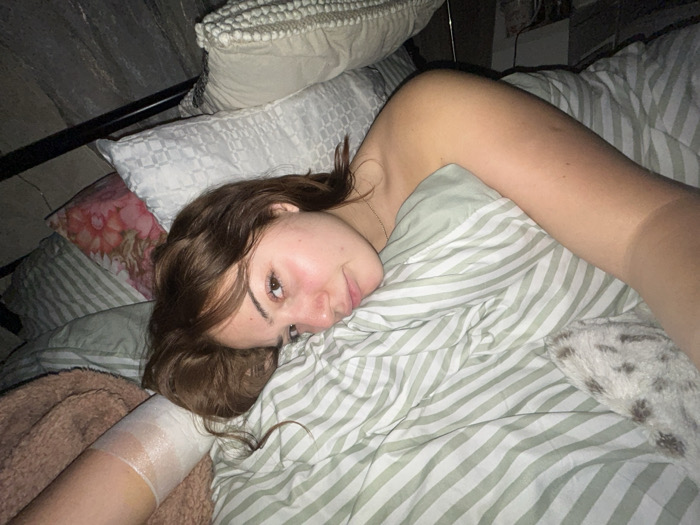 A woman lies in bed with several pillows behind her. She has brown hair and fair skin. Her left arm has a bandage. She's partially covered by striped green and white bedding. A brown fuzzy blanket is visible on the left. The headboard of the bed and more pillows are visible in the background. She is looking at the camera with a slight smile.