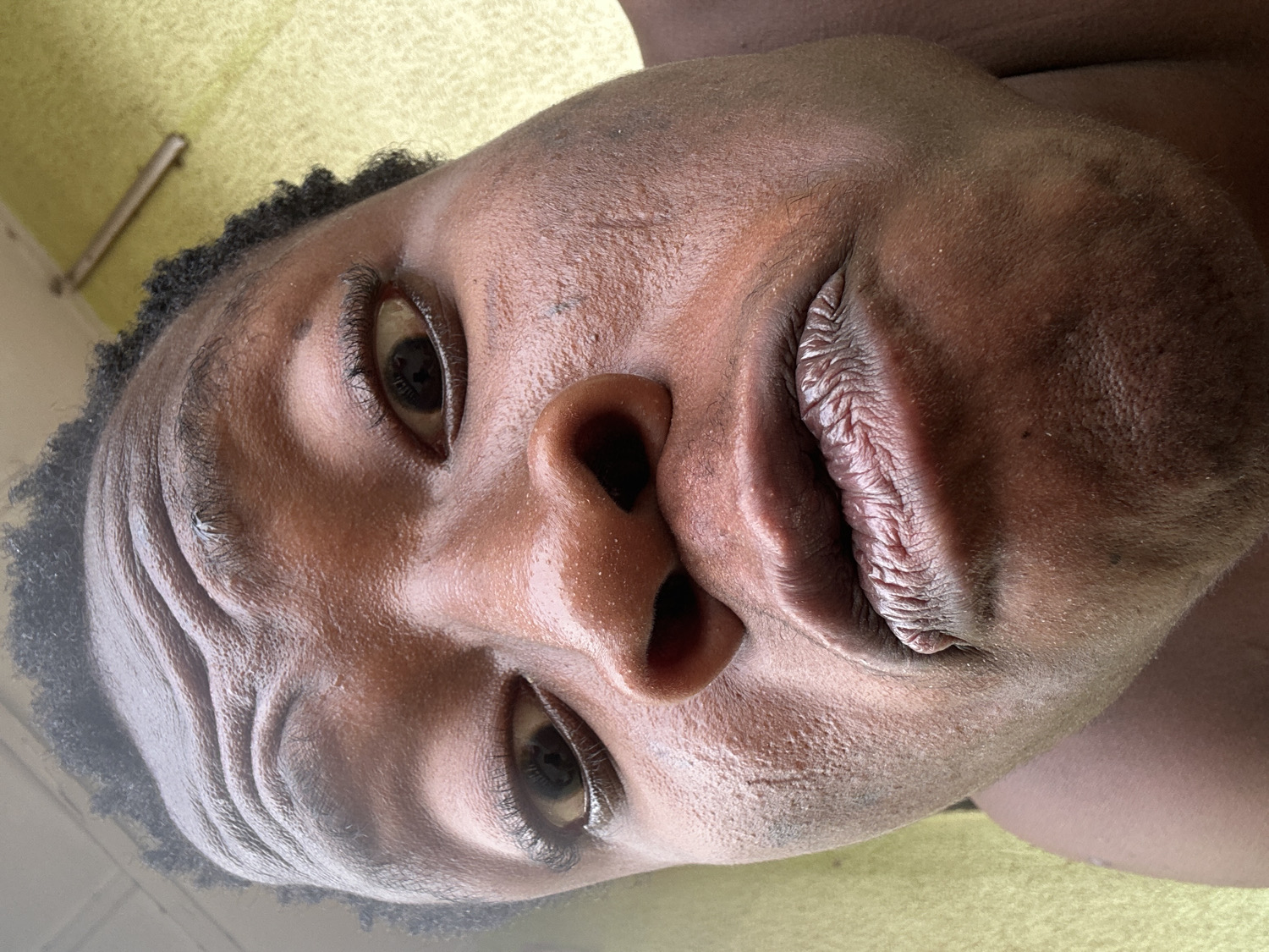 The media file presents a close-up portrait of a person's face, captured from a low angle and oriented sideways. The individual appears to be an adult with dark skin, dark eyes, and short, tightly curled dark hair visible along the hairline. Their expression is neutral, and they are looking directly upwards or slightly past the camera.
The skin on the face has a somewhat dewy or oily appearance, with visible pores and natural texture, including some wrinkles on the forehead. The lips are full and exhibit a distinct, textured surface. Both eyes are open, with dark irises and visible eyelashes.
In the background, a muted light yellow or greenish surface is visible, possibly suggesting a wall or fabric, and a faint rectangular object can be seen in the upper left portion. The lighting appears bright and even, suggesting daylight or well-lit indoor conditions. There is no visible text in the image.