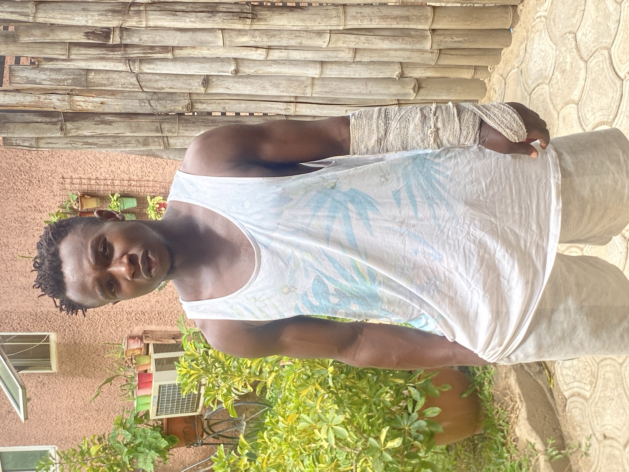 An African man is outdoors in an urban area of Barden Yana, Nigeria. He has a bandage on his left forearm and hand. He is wearing a white tank top with a light blue floral pattern and light gray shorts. Behind him is a tan wall, window, air conditioning unit, and foliage. The background has a wooden bamboo fence and a stone tile pathway.