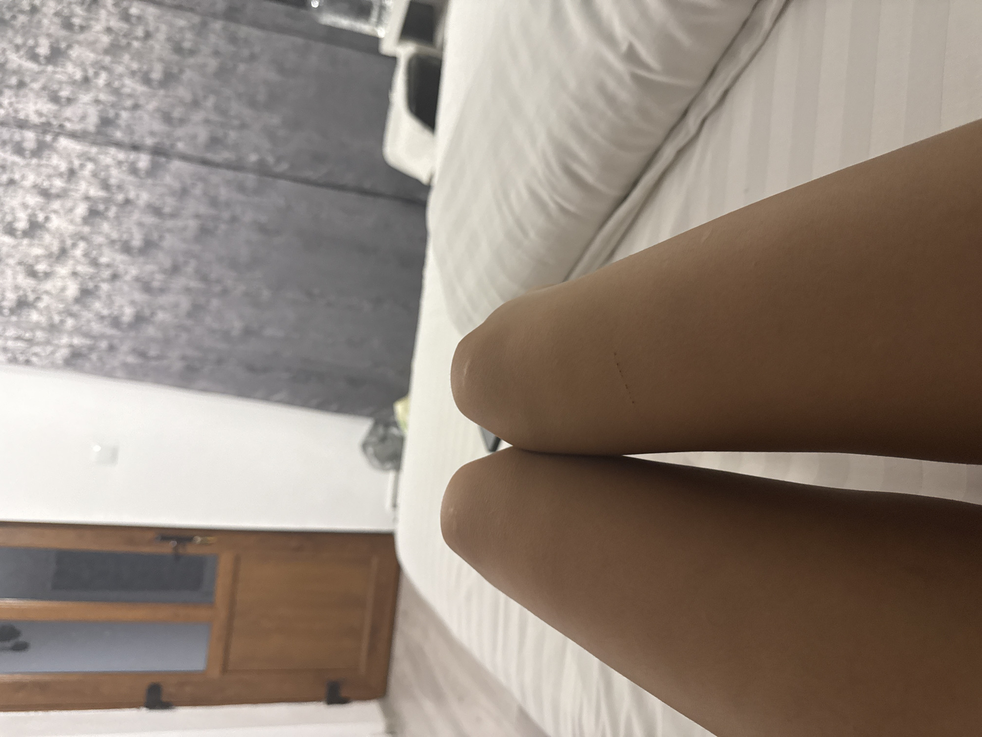 A close-up shot focuses on the legs of a person lying on a bed. The legs are tanned and appear to be bare. The bed has white striped sheets and a white pillow. In the background, a wooden door with glass panels is visible on the left. To the right, gray curtains hang, and a nightstand with a glass of water is present. The overall setting suggests a bedroom in Cârțișoara, Romania.