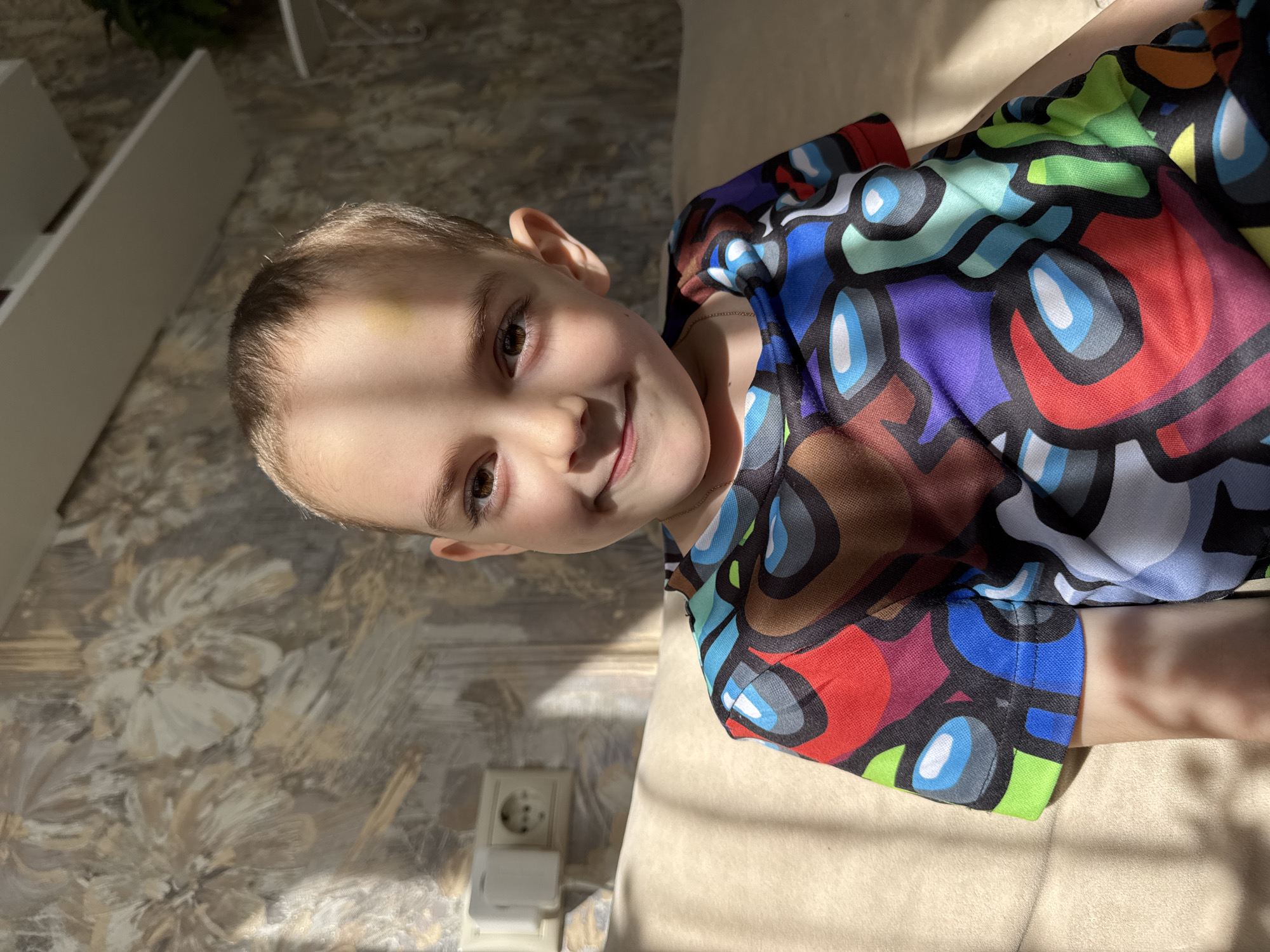 A young boy is indoors in Razdolie, Russia. He is fair-skinned with brown eyes and short, light brown hair. There is a yellow bruise near his left temple. He is wearing a colorful shirt with rounded rectangular shapes. He is smiling at the camera. The background includes a floral pattern wallpaper, an electrical outlet, and a beige sofa. Sunlight is cast across the scene.
