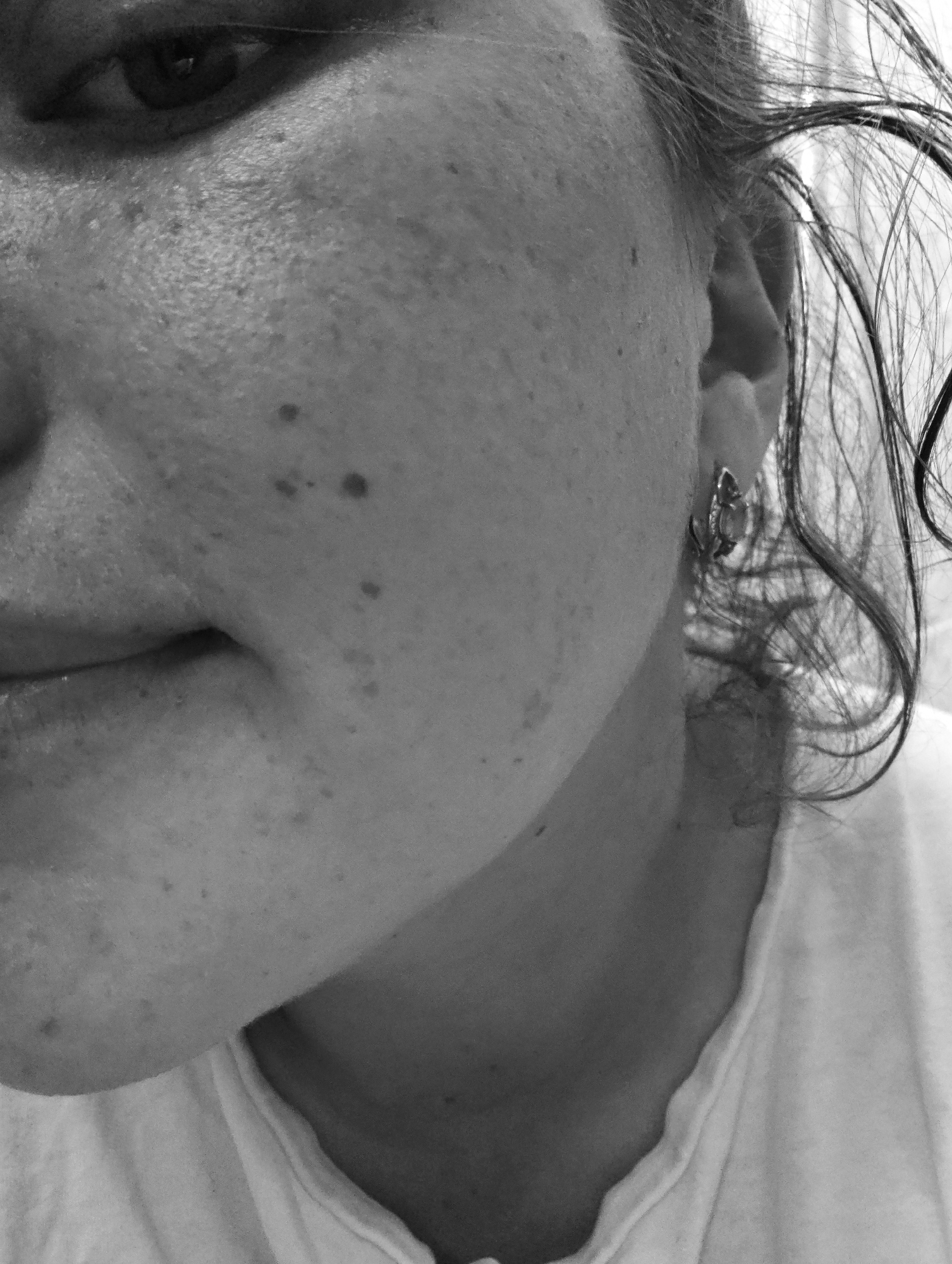 A black and white, close-up photograph shows a portion of a person's face. The eye is visible in the upper left corner. The skin has freckles and a couple of dark spots. Part of the mouth is visible. The person is wearing earrings. Hairs frame part of the face. The person is wearing a light-colored t-shirt. There is no discernible indication of the location being in Chaikovsky, Russia.