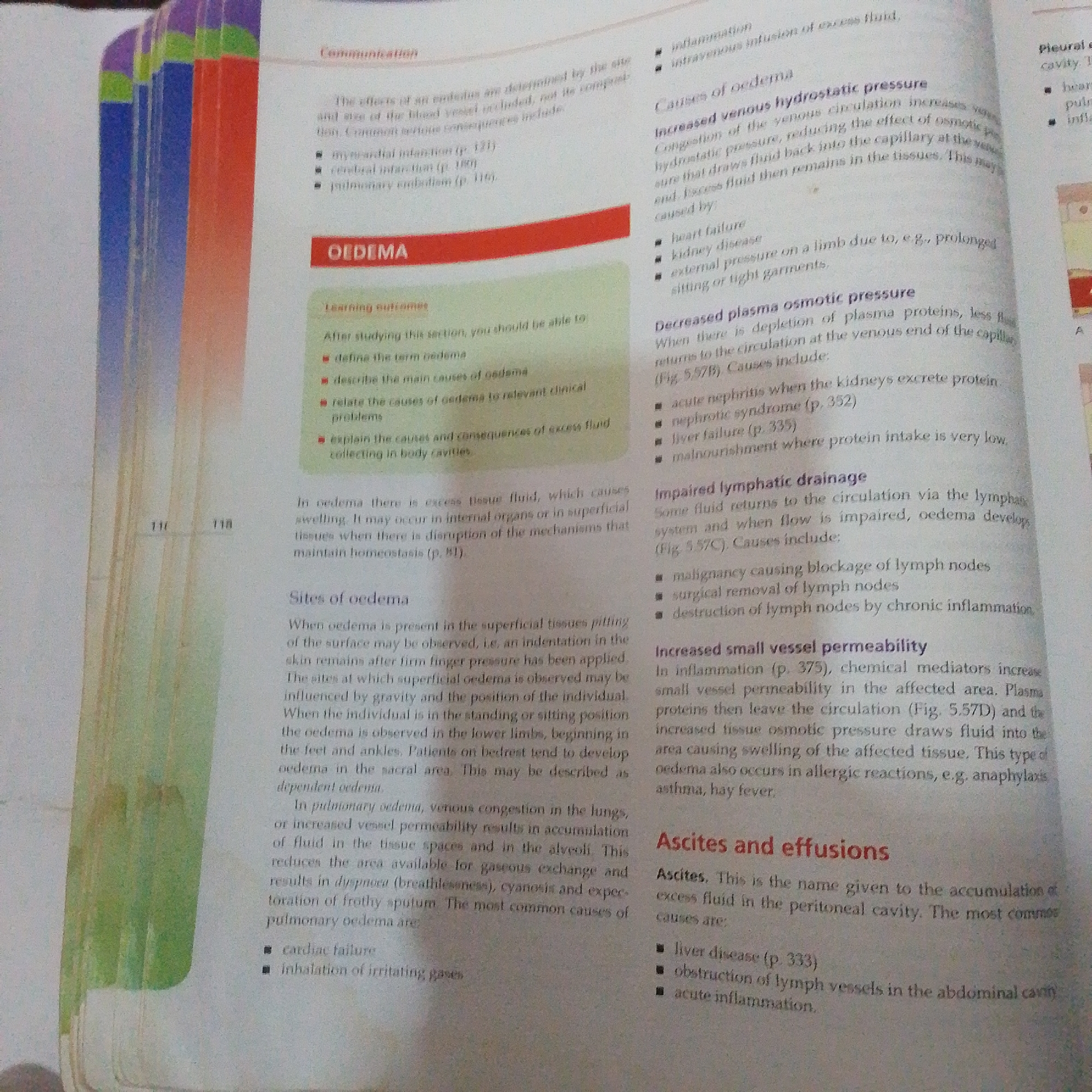 The image displays a page from a medical textbook discussing edema. The text is organized into sections with headings such as "Causes of oedema," "Increased venous hydrostatic pressure," "Decreased plasma osmotic pressure," "Impaired lymphatic drainage," "Increased small vessel permeability," and "Ascites and effusions." There are bullet points listing various causes and consequences. The page also includes some page numbers and visual cues indicating it's part of a larger publication. There is no information in the image related to Jalingo, Nigeria, or any forensic scene.