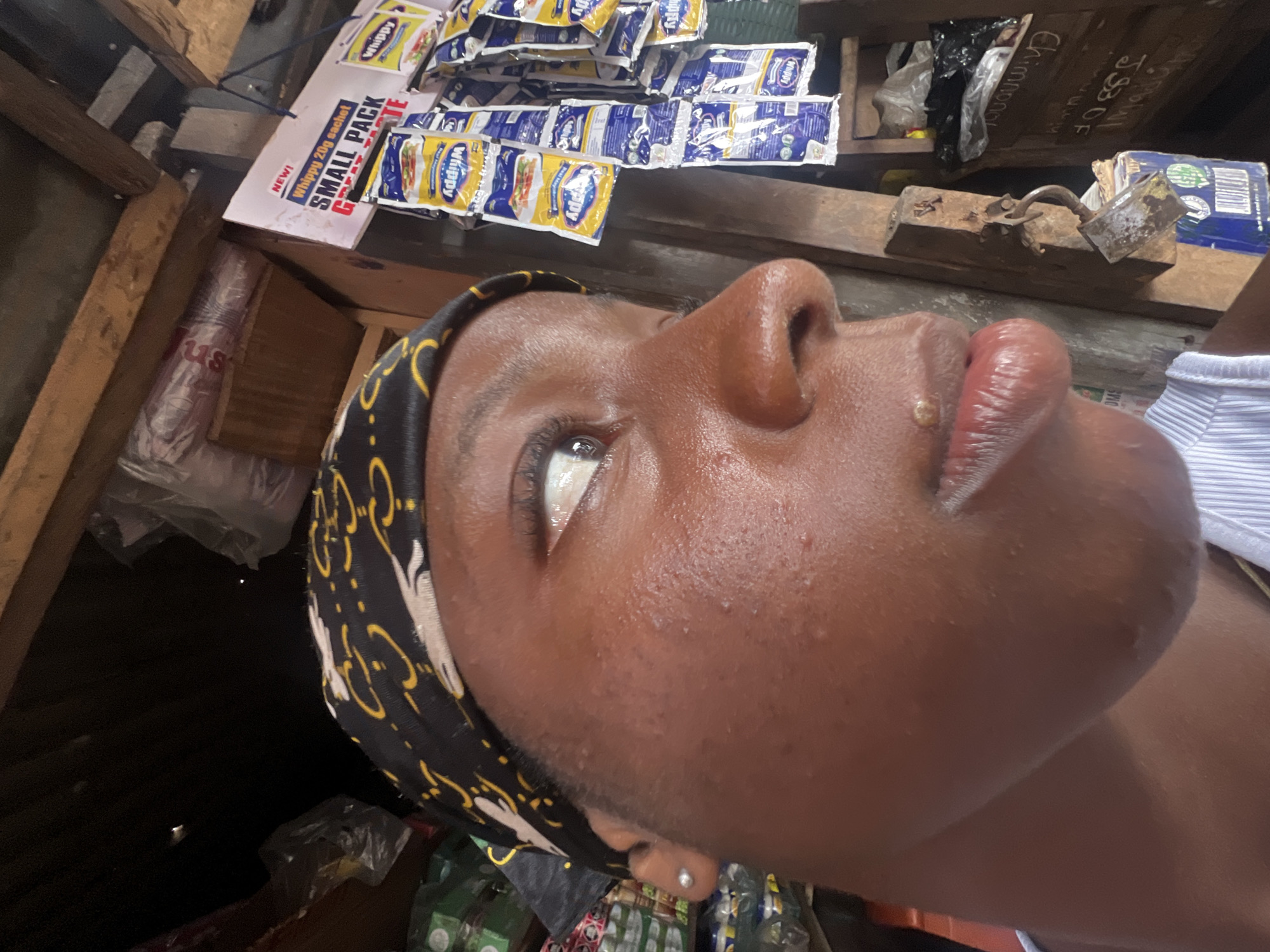 The image shows a close-up, profile view of a young Black woman's face, looking to her right. She is wearing a black bandana with yellow swirls. Her skin appears oily and has some minor blemishes. She has a small, light-colored blemish on her upper lip. Her eyes are open, and her gaze is directed upwards and to the right.
In the background, the scene appears to be an outdoor market stall, likely in Nkpor, Nigeria, given the presence of various packaged goods. To the right of the woman, several rows of small, colorful sachets are hanging, possibly food items or seasonings. A white sign with blue lettering reads "NEW! WHIPPY 20g SACHET SMALL PACK GREAT TASTE". Various other products are visible on shelves and in the background, some in clear plastic packaging. The overall environment suggests a bustling, informal marketplace. The lighting is somewhat dim, creating shadows in some areas.
