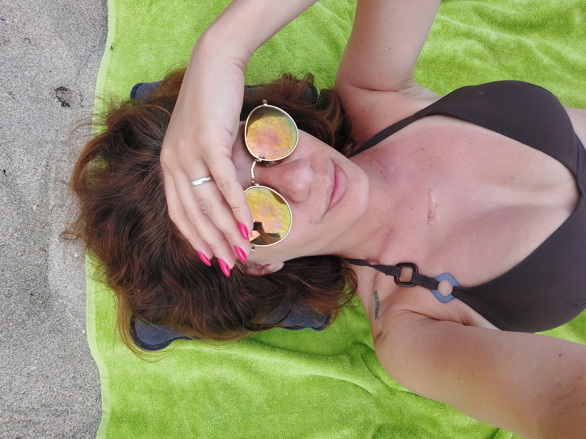 A woman lies on a bright green towel on a sandy beach in Kiten, Bulgaria. She is wearing a dark brown bikini and gold-rimmed sunglasses with yellow lenses. Her right hand, with bright pink fingernails, is raised to her forehead, obscuring part of the sunglasses. A silver ring is visible on her ring finger. A tattoo is visible on her left shoulder. The sand of the beach is in the background above her head, and part of her chest, including a surgical scar, is visible.