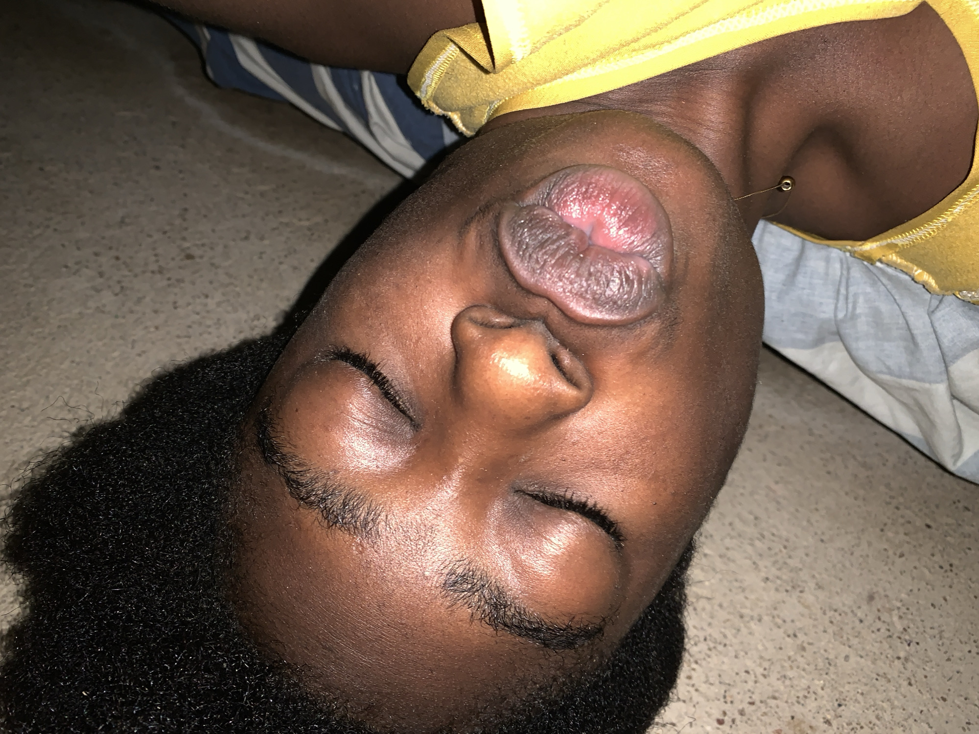 A person is lying on their back with their head tilted to the side, facing the camera. They are wearing a yellow t-shirt. The person's eyes are closed, and their lips are slightly parted. The background appears to be a concrete surface with a striped pillow or blanket visible. The image was taken in Rafin Par, Nigeria.