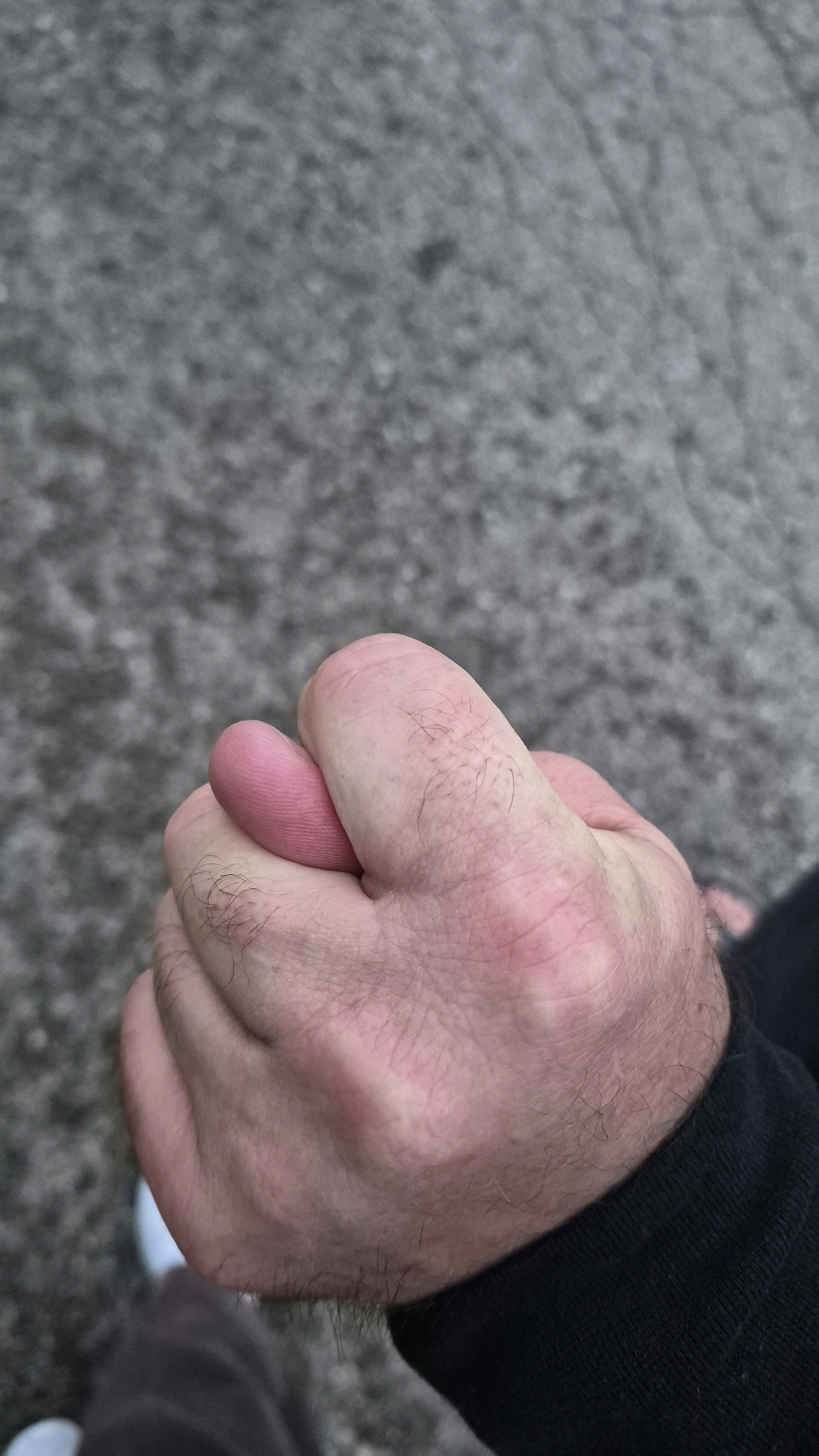 The image shows a close-up of a person's hand. The hand is pale pink and appears to be resting against a dark fabric, possibly a sleeve. The knuckles are slightly red. A thumb is bent inwards, pressing against the palm. The background is a blurry, grey, textured surface, consistent with asphalt or concrete. There is no visible indication of the location being Krauja, Latvia, or any other specific geographical area. The focus is entirely on the hand and its immediate surroundings.