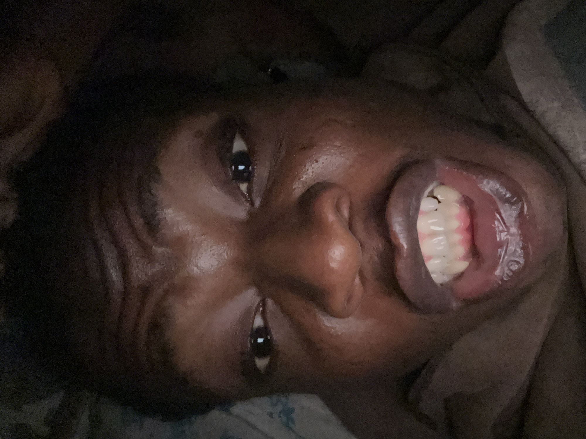 A close-up, low-angle, portrait-oriented image shows a dark-skinned individual with their mouth open wide, revealing teeth and the interior of the mouth. The person's head is slightly tilted to the side. The person is lying on a soft, patterned surface. The environment is dark. The location is Unknown, Unknown.