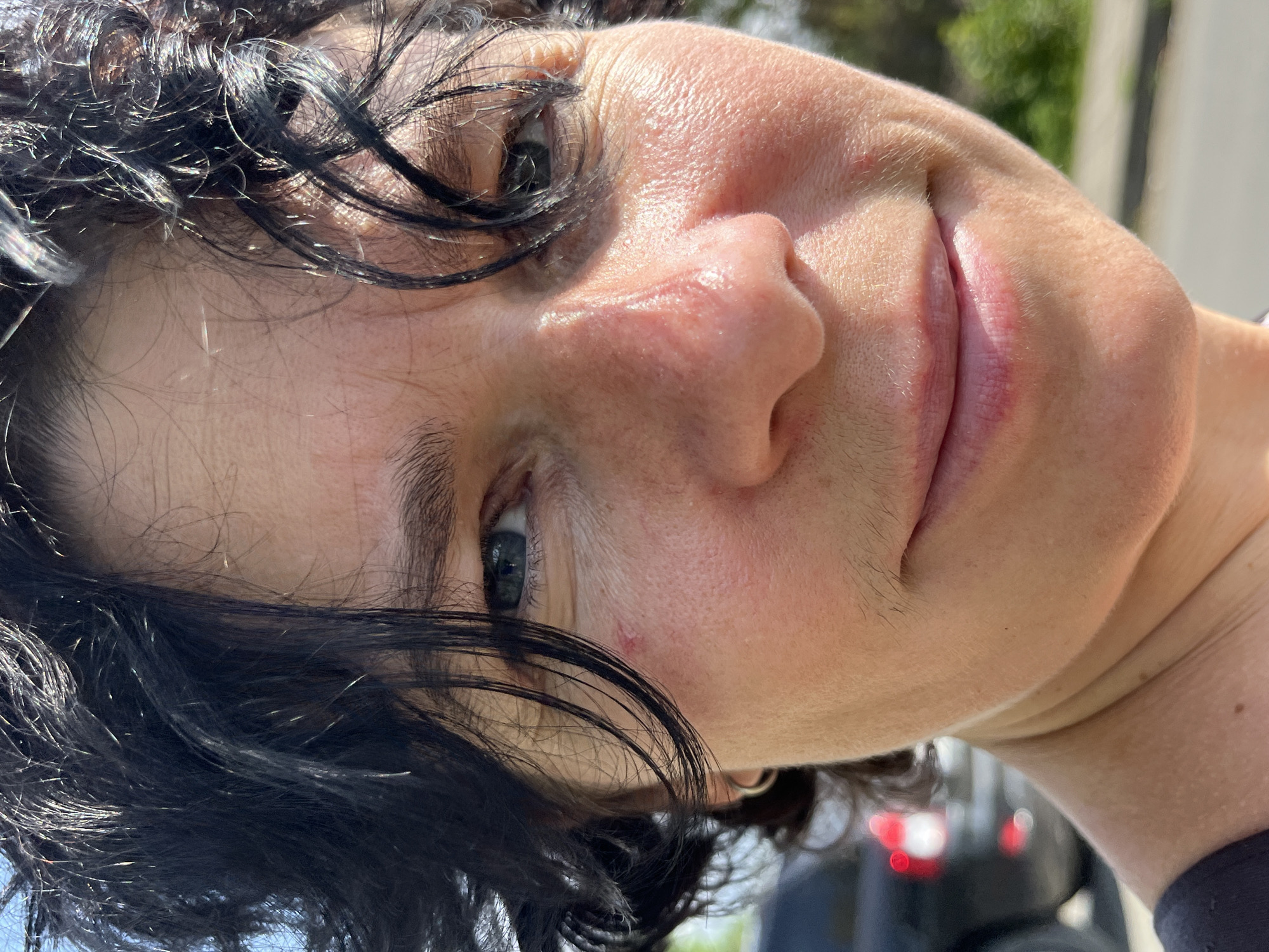 This is a close-up, head-and-shoulders shot of a person with dark, curly hair and blue eyes, taken outdoors on a sunny day. The person's face is turned slightly to the right, and they are smiling. Their skin appears fair with some redness on the cheeks and around the nose. A small red mark is visible on the left cheek. The background is slightly blurred, showing a car and greenery, suggesting an outdoor urban or suburban environment. The image was taken in Ureki, Georgia.