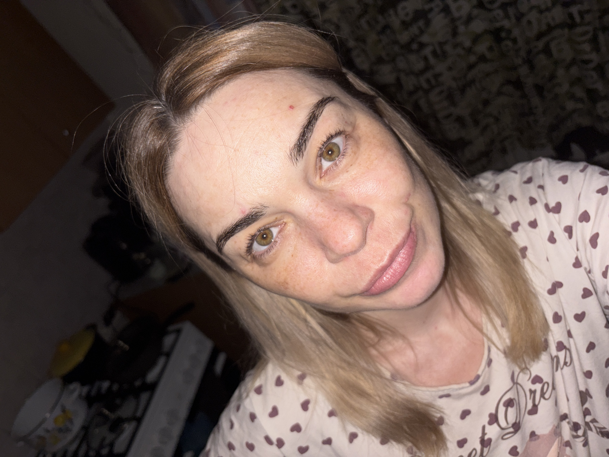 The image shows a close-up, slightly angled selfie of a light-skinned woman with blonde hair and green-brown eyes. She is wearing a light-colored pajama top with a pattern of small, dark pink hearts. Her skin has some freckles and appears to be slightly flushed. There are a couple of small red marks on her forehead and cheek. Her lips are a light pink color, and she is looking directly at the camera. The background is dark and out of focus, with some indistinct shapes suggesting an indoor environment. There are no visible landmarks or details that would indicate the location in Ladozhskoe Ozero, Russia.