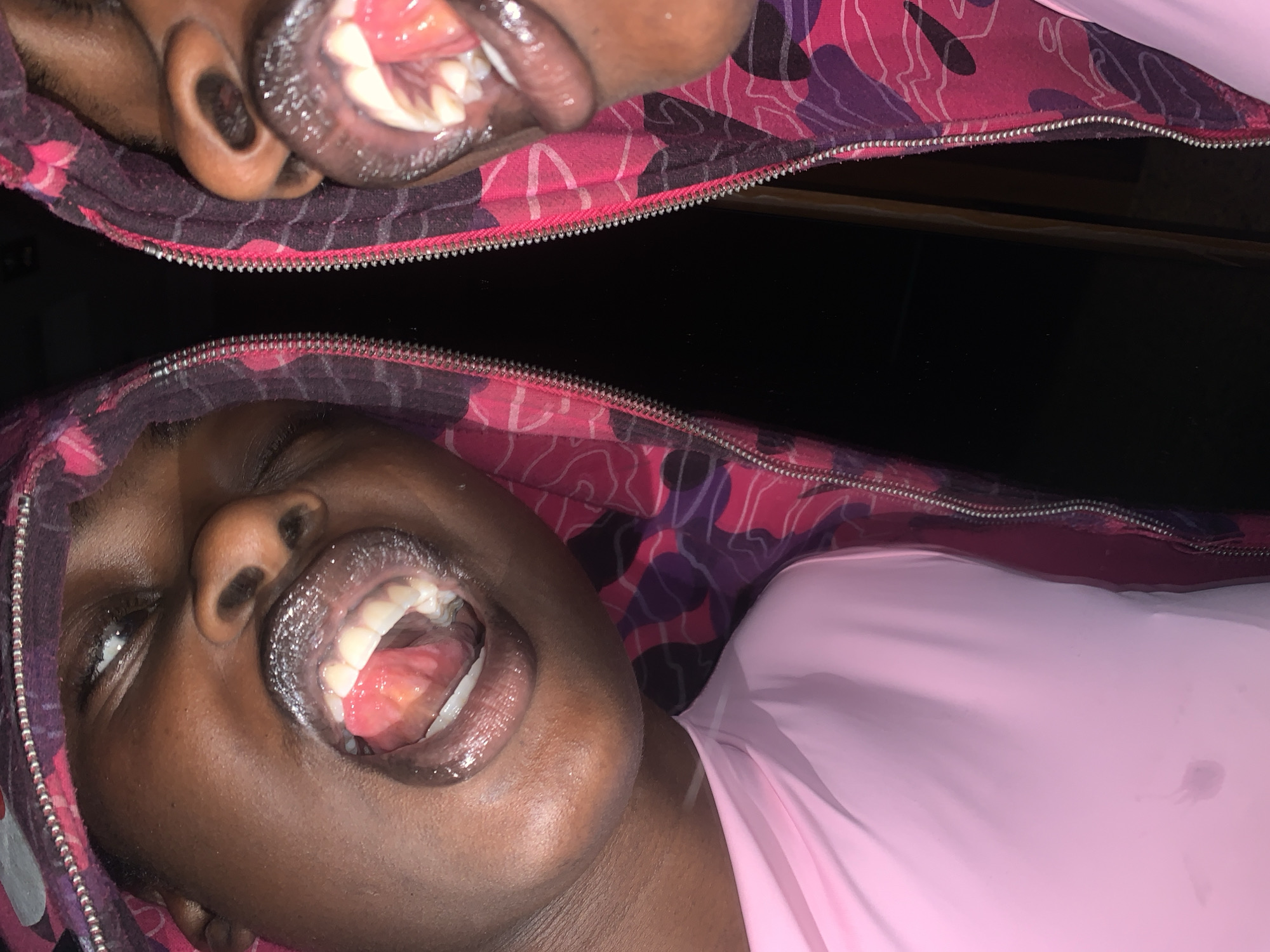 The image shows a close-up of a person's face, specifically their mouth and part of their head, with a reflection of the same person to the right. The person has dark skin and is wearing a pink garment and a hooded jacket with a camouflage pattern of pink and purple. Their mouth is open, revealing teeth and the inside of their mouth, which appears moist. The lighting is dim, and the background is dark. The scene is likely indoors, possibly a personal space, given the close proximity and focus on the individual. There is no visible indication of the location being in Gura Top, Nigeria.