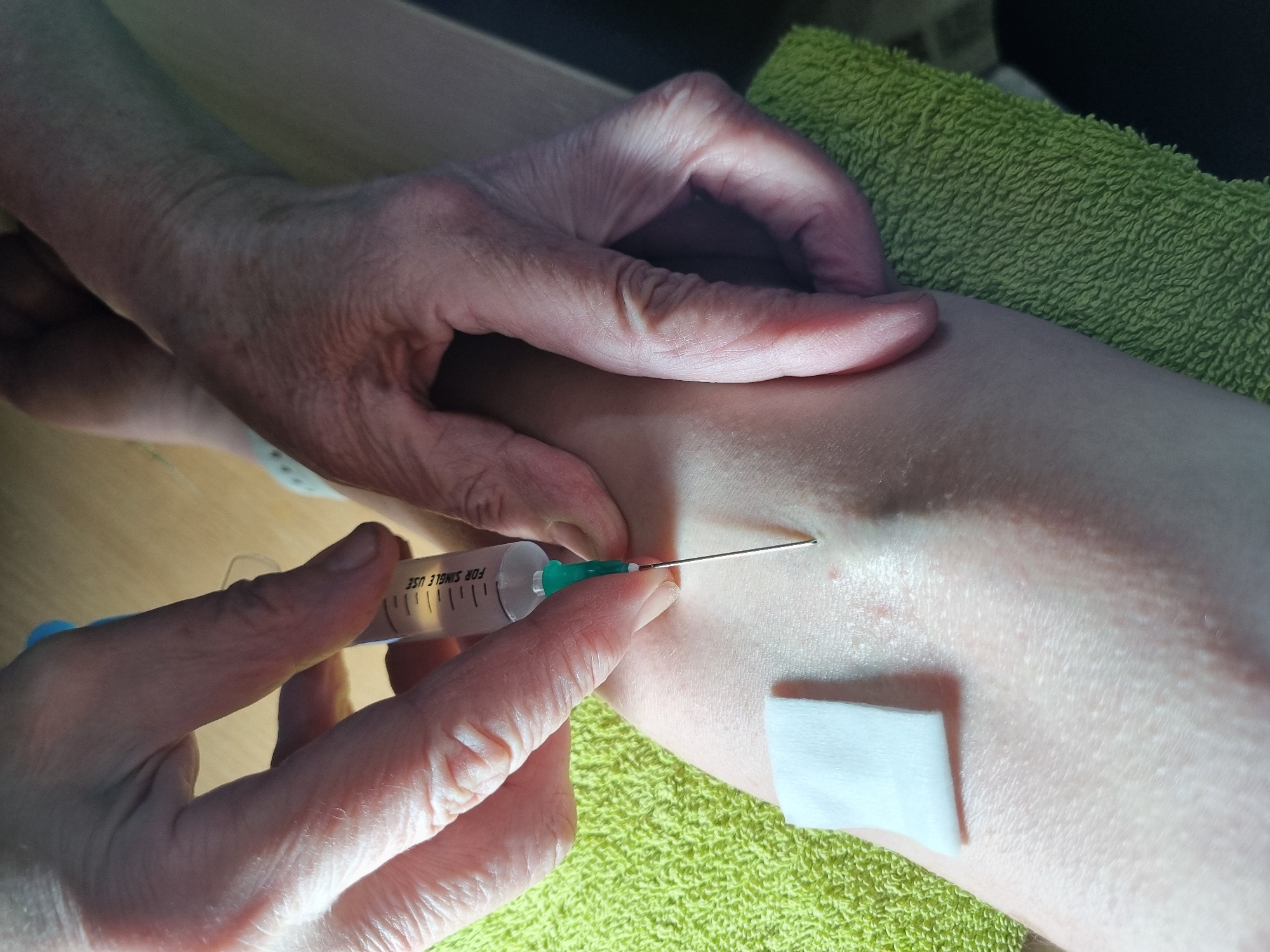 A close-up shot captures a medical procedure, likely an injection, taking place in Chaikovsky, Russia. The image features two sets of hands and a person's arm or leg. An older, visibly wrinkled hand gently steadies the skin around the injection site. A second hand holds a clear syringe with a metallic needle, which is partially inserted into the skin of the arm or leg. The clear body of the syringe displays the text "FOR SINGLE USE". A clean, white cotton pad is visible on the skin, positioned near the injection area. The procedure is being performed over a bright green, textured towel, suggesting an indoor, possibly clinical or home care setting. No specific time of day or emotional expressions are discernible.