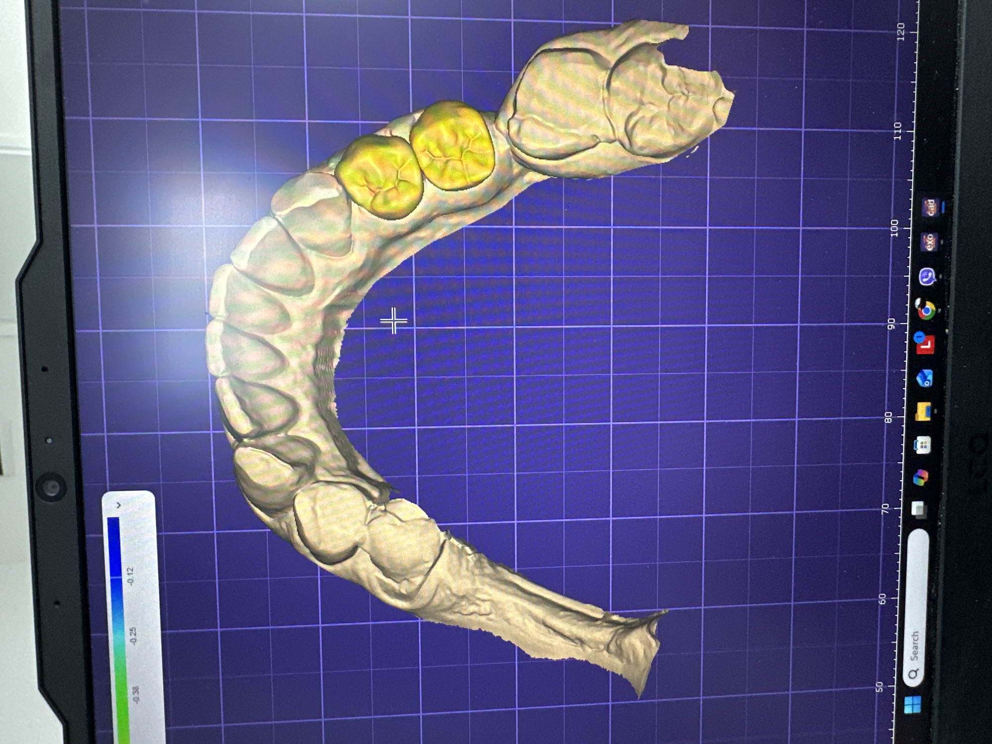 The image displays a digital 3D model of dental work, likely a lower jaw model, viewed on a computer screen. The model shows teeth, with two prominent molars highlighted in yellow, suggesting they may be a focus of the dental work or analysis. A color gradient bar at the top indicates a scale, possibly representing depth or measurement, with values ranging from -0.38 to -0.12. A grid pattern is visible on the screen, superimposed over the 3D model. The computer screen is part of a laptop with a webcam at the top. The bottom of the screen shows a Windows taskbar with icons, including a search bar. The image does not provide any information about the location in Gotse Delchev, Bulgaria.
