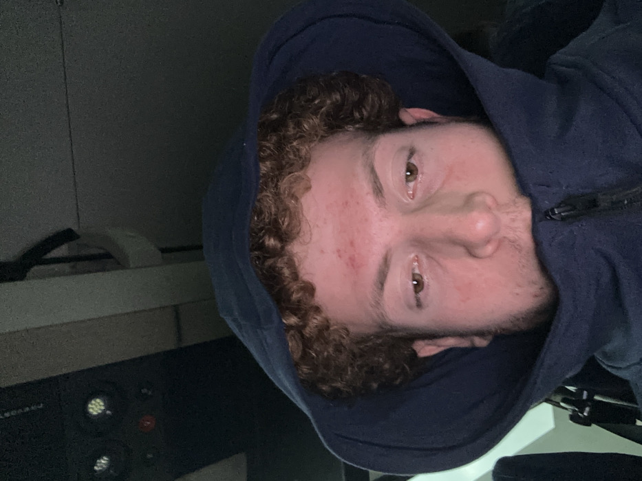A person with curly brown hair wears a dark blue hoodie, the hood pulled up. They have light skin with some redness on their forehead and cheeks. Their eyes are hazel. The image is rotated, positioning the person's face at an unusual angle. The background appears dark, with some equipment and a desk visible in the periphery, suggesting an indoor setting.
