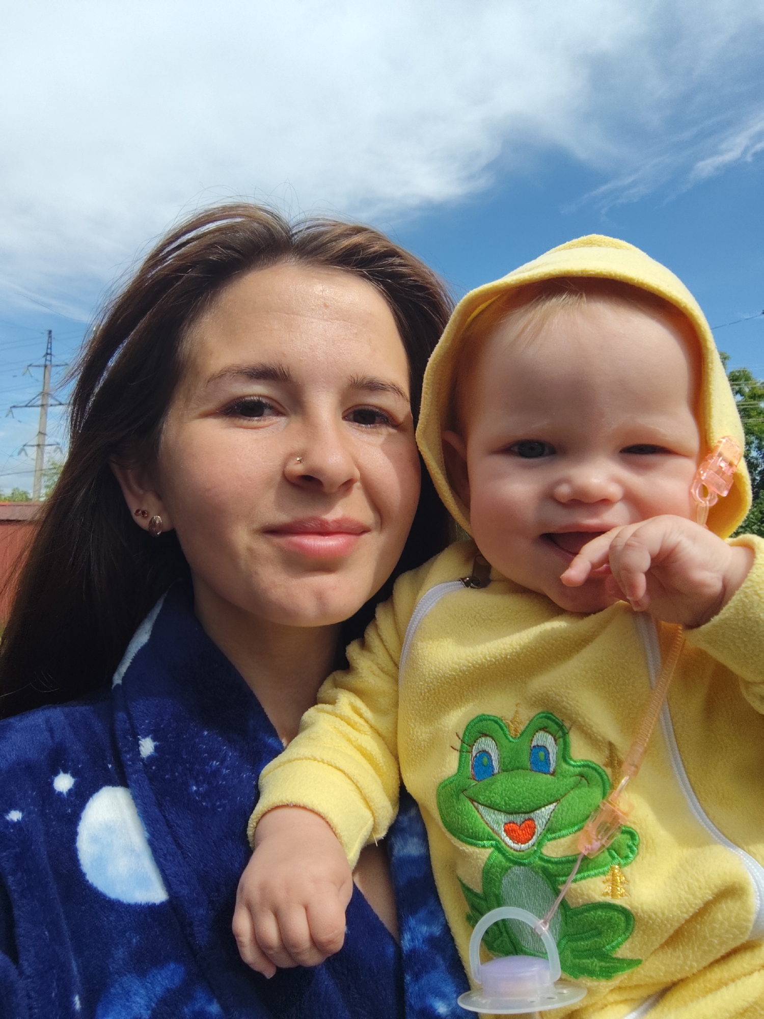 A medium shot selfie shows a young woman holding a baby outdoors under a blue sky with scattered white clouds. The woman is on the left, with long dark brown hair and a blue robe with a white moon and star pattern. She is smiling, and her right arm is around the baby. The baby is on the right, wearing a yellow hooded outfit with a cartoon frog applique. The baby is smiling and has a pacifier attached to its outfit. In the background, there are power lines and some trees, suggesting an outdoor, possibly suburban or rural, setting. No specific location in the city of Фоки, Russia can be identified from the visual information provided.