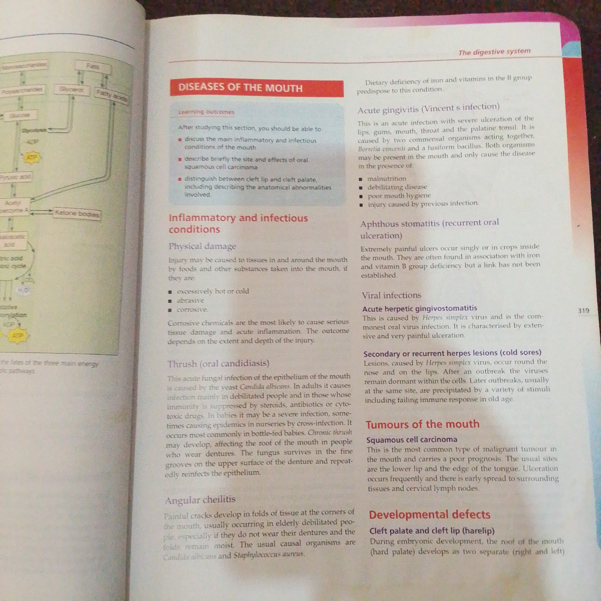 This media file is a photograph of an open textbook, likely a biology or medicine textbook, depicting a page titled "DISEASES OF THE MOUTH". The page is divided into several sections, each discussing different oral conditions.
On the left side of the page, there is a diagram illustrating a metabolic pathway, likely related to cellular respiration or energy production, with labels such as "Fats", "Glucose", "Glycolysis", "ATP", "Pyruvic acid", and "Ketone bodies". Below this diagram, there is a caption that appears to be cut off but starts with "the fates of the three main energy...".
The right side of the page is dedicated to describing various oral diseases. Visible headings include "DISEASES OF THE MOUTH", "Learning outcomes", "Inflammatory and infectious conditions", "Thrush (oral candidiasis)", "Angular cheilitis", "Acute gingivitis (Vincent s infection)", "Aphthous stomatitis (recurrent oral ulceration)", "Viral infections", "Acute herpetic gingivostomatitis", "Secondary or recurrent herpes lesions (cold sores)", "Tumours of the mouth", "Squamous cell carcinoma", and "Developmental defects".
Specific text visible includes descriptions of these conditions, their causes, symptoms, and potential risk factors. For example, under "Acute gingivitis", it mentions causes like "Borrelia vincenti and a fusiform bacillus" and contributing factors such as "malnutrition", "debilitating disease", and "poor mouth hygiene". Under "Thrush (oral candidiasis)", the yeast "Candida albicans" is mentioned as the cause. The text also references "Herpes simplex virus" as the cause of herpetic infections.
A page number, "319", is visible in the bottom right corner of the right-hand page. The lighting suggests an indoor setting, possibly a classroom or study area, with natural light illuminating the page. There are no people or specific location cues to suggest Jalingo, Nigeria, other than the prompt's context. The overall scene is that of educational material being presented for study.