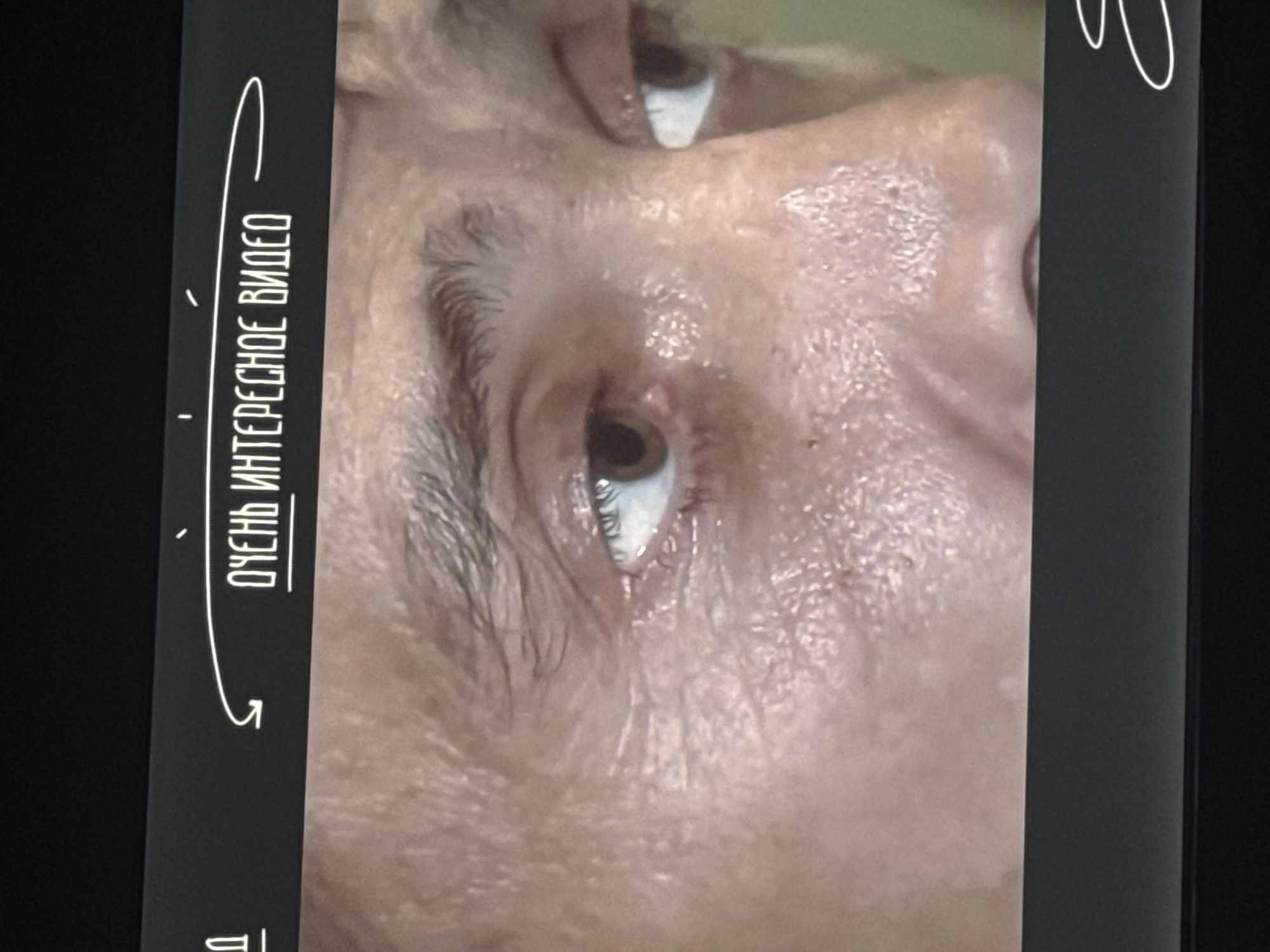 The image shows a close-up of a person's eyes and the surrounding facial skin, which appears to be sweating. Above the eyes, a black bar displays text in Russian that translates to "Very Interesting Video". The image is likely a screenshot from a video, possibly taken in Saratov, Russia, as requested. No specific location in Saratov can be identified from the image.