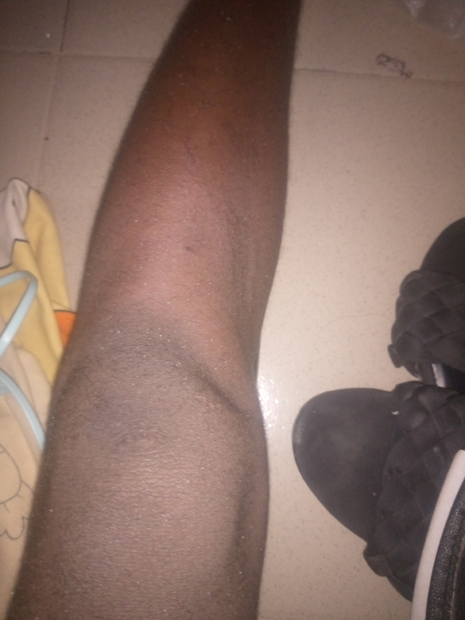 This is a close-up, low-angle, full-body shot of a person's lower leg and foot, placed on a tiled floor. The person's skin appears dark, with some visible pores and texture. The leg is bent at the knee, which is slightly visible in the upper portion of the frame. To the left of the leg, a portion of a yellow garment with an orange trim and a white strap is visible, likely clothing. To the right of the leg, a black quilted sandal is visible, worn by the person. The sandal has a white trim along the edge. The floor is made of light-colored square tiles. The scene appears to be indoors, possibly in a residential setting. Based on the limited visual information, it is not possible to determine the specific location within Jalingo, Nigeria.