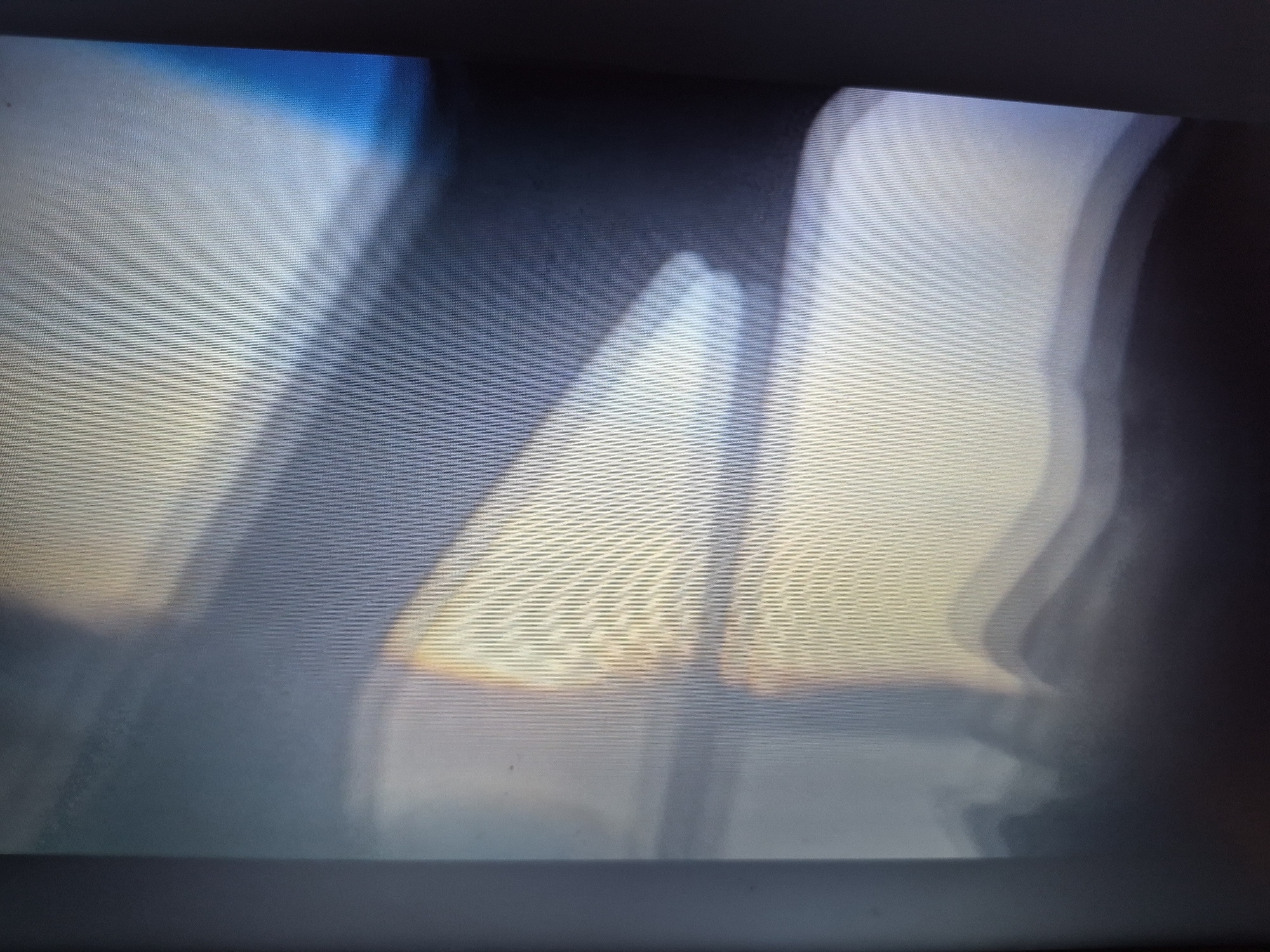 The image displays a distorted, abstract view of what appears to be light and shadow. The dominant colors are shades of blue, white, yellow, and dark gray. The texture of the image suggests it was captured on a screen with a visible pixel grid and horizontal lines. There are no discernible people, subjects, objects, actions, or interactions. The environment is not identifiable and it is not possible to determine the location within the city of Sandwell, United Kingdom.