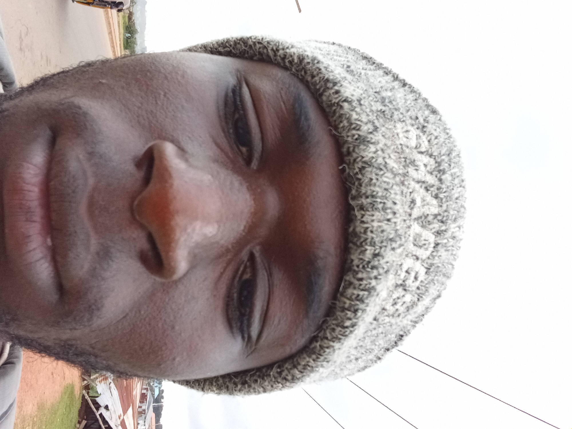 The image is a low-angle, close-up selfie of a Black man wearing a grey knit beanie. The man's face dominates the frame, with his eyes, nose, and mouth prominently visible. His skin appears to be dark and smooth, with some light sweat on his forehead. His eyes are dark and focused, and his lips are slightly parted. He has a light beard and mustache. The background is out of focus and appears to be an outdoor environment. To the left, a road and a vehicle with yellow and black markings are visible. To the right, there are some buildings with corrugated metal roofs and some vegetation. The sky is overcast and light-colored. The man's expression is neutral. The image does not provide any specific details about the city or its location, so it is impossible to determine its placement.