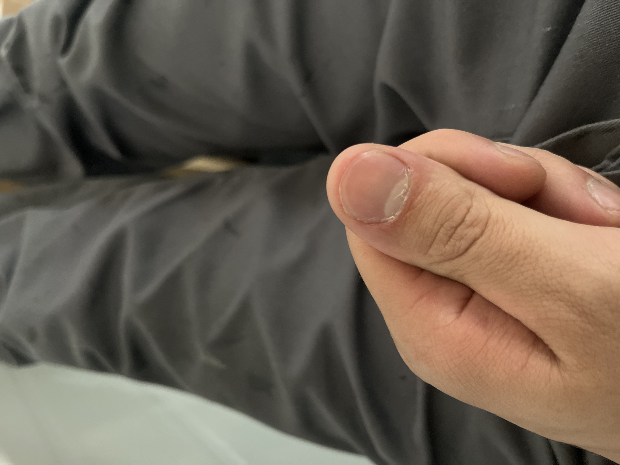 A close-up shot focuses on a person's right thumb, which is partially obscuring a grey fabric surface, likely pants. The thumb shows a clean fingernail with a light crescent moon shape at the base. The skin is a light tone with visible fingerprints and some redness around the nail bed. The background is dominated by the folds and texture of the grey fabric, which appears to be woven material. The lighting suggests an indoor environment with diffused light. There are no visible indicators of the specific location within Kyiv, Ukraine.