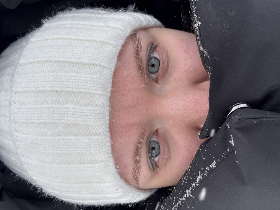 A close-up, head-on portrait captures an individual's upper face in Nizhnekamsk, Russia. The person is clad in a white, ribbed knit beanie hat and a black winter jacket or coat, with the collar drawn up to obscure the lower half of the face, leaving visible only the eyes, eyebrows, forehead, and the bridge of the nose. Small white crystalline particles, consistent with snow or ice, are present on the white hat, the individual's eyebrows, and the black jacket's fabric. The eyes are light blue-grey, with black eyeliner visible along the lower lash lines. The exposed skin on the forehead and around the eyes displays a pinkish tone, indicative of cold exposure. The individual's gaze is directed forward, towards the camera. The background is indistinct and dark, suggesting an outdoor winter setting with focus primarily on the subject.