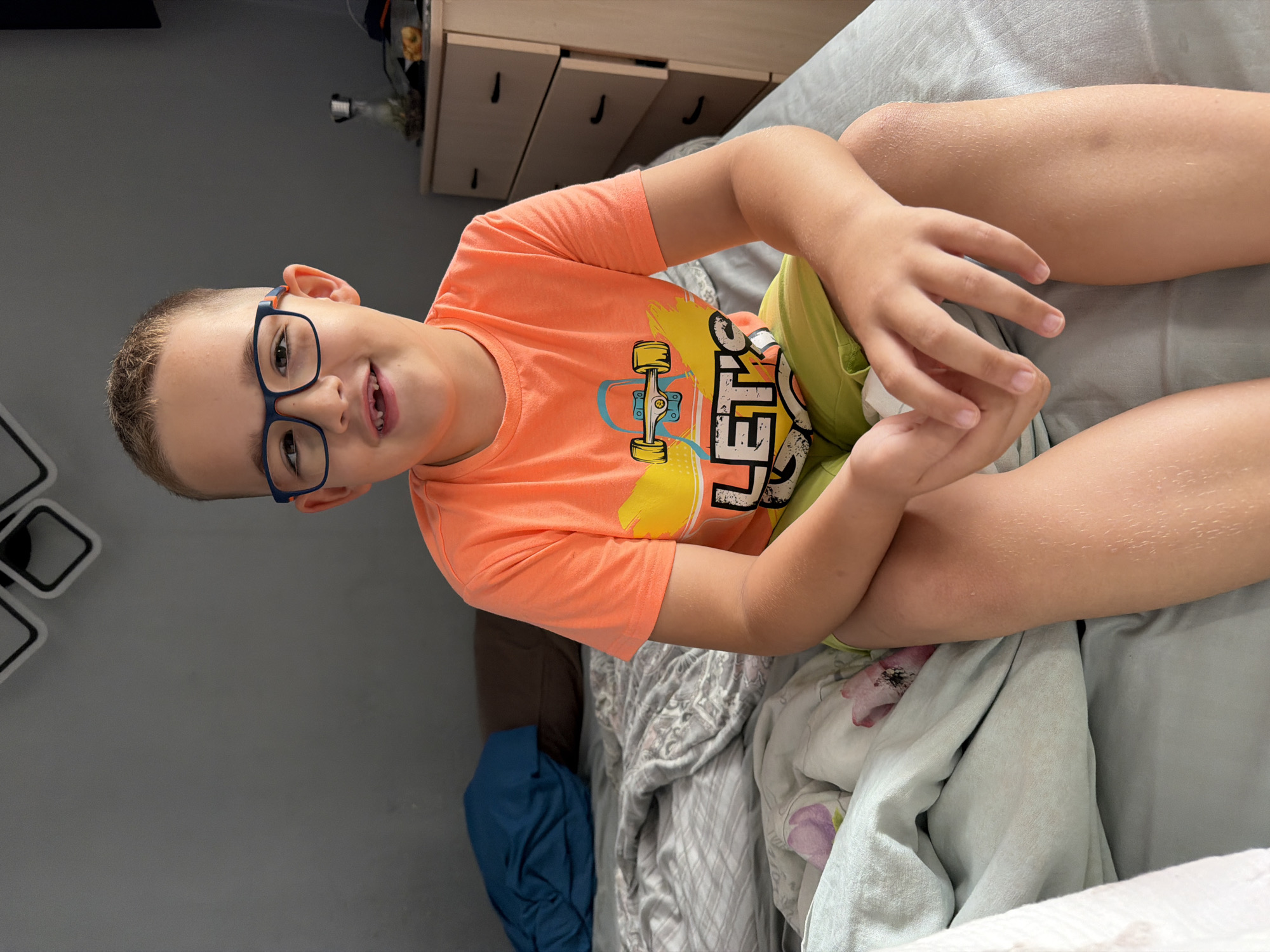 A young boy with short, light brown hair and blue-framed glasses is lying on a bed, looking directly at the camera with a wide smile, revealing a missing front tooth. He is wearing an orange short-sleeved t-shirt with a graphic of a skateboard and the word "LET'S" visible on it, paired with light green shorts. His arms are bent, with his hands resting near his stomach. His skin on his arms and legs shows some texture, possibly indicating goosebumps or slight dryness.
The boy is situated in an indoor setting, likely a bedroom in Sochi, Russia. He is lying on a bed covered with light blue or grey bedding, which appears to have a subtle pattern. A portion of a floral pattern is visible on one side of the bed. In the background, to the left, is a grey wall with a modern decorative item featuring interconnected square shapes. To the right, a light-colored wooden dresser or set of drawers with dark, curved handles is visible. The room is well-lit, suggesting it is daytime. The overall impression is one of relaxation and happiness.