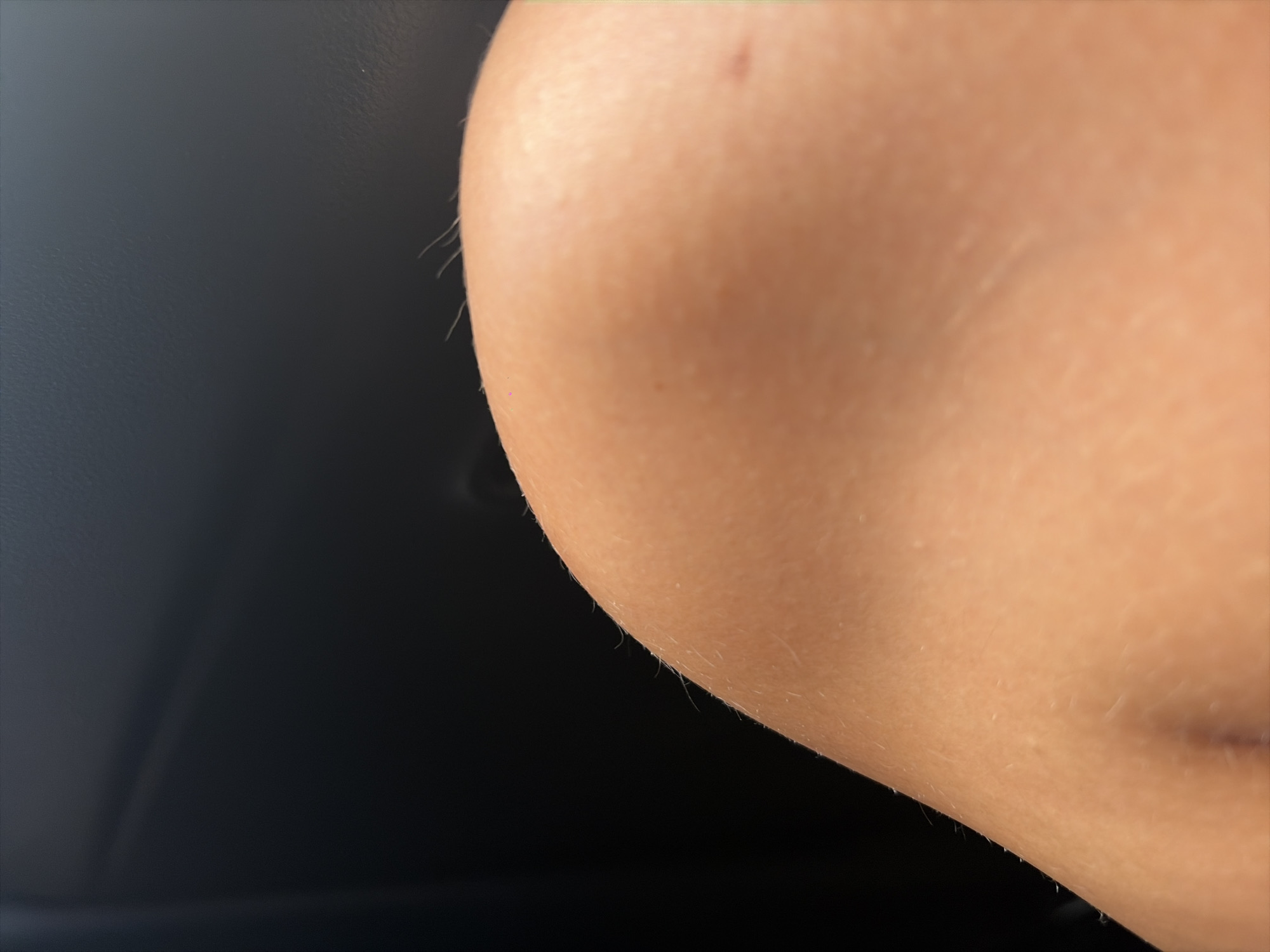 This is a close-up, low-angle, eye-level, medium shot of a portion of a person's knee against a dark background, possibly a car interior. The skin is smooth and tanned with fine hairs visible along the top curve of the knee. A faint reddish mark is present on the skin's surface. The dark background is out of focus, with a slight hint of light or shadow streaks. The image does not provide enough information to determine the location within Ubud District, Indonesia, or any specific details about people, actions, or interactions.