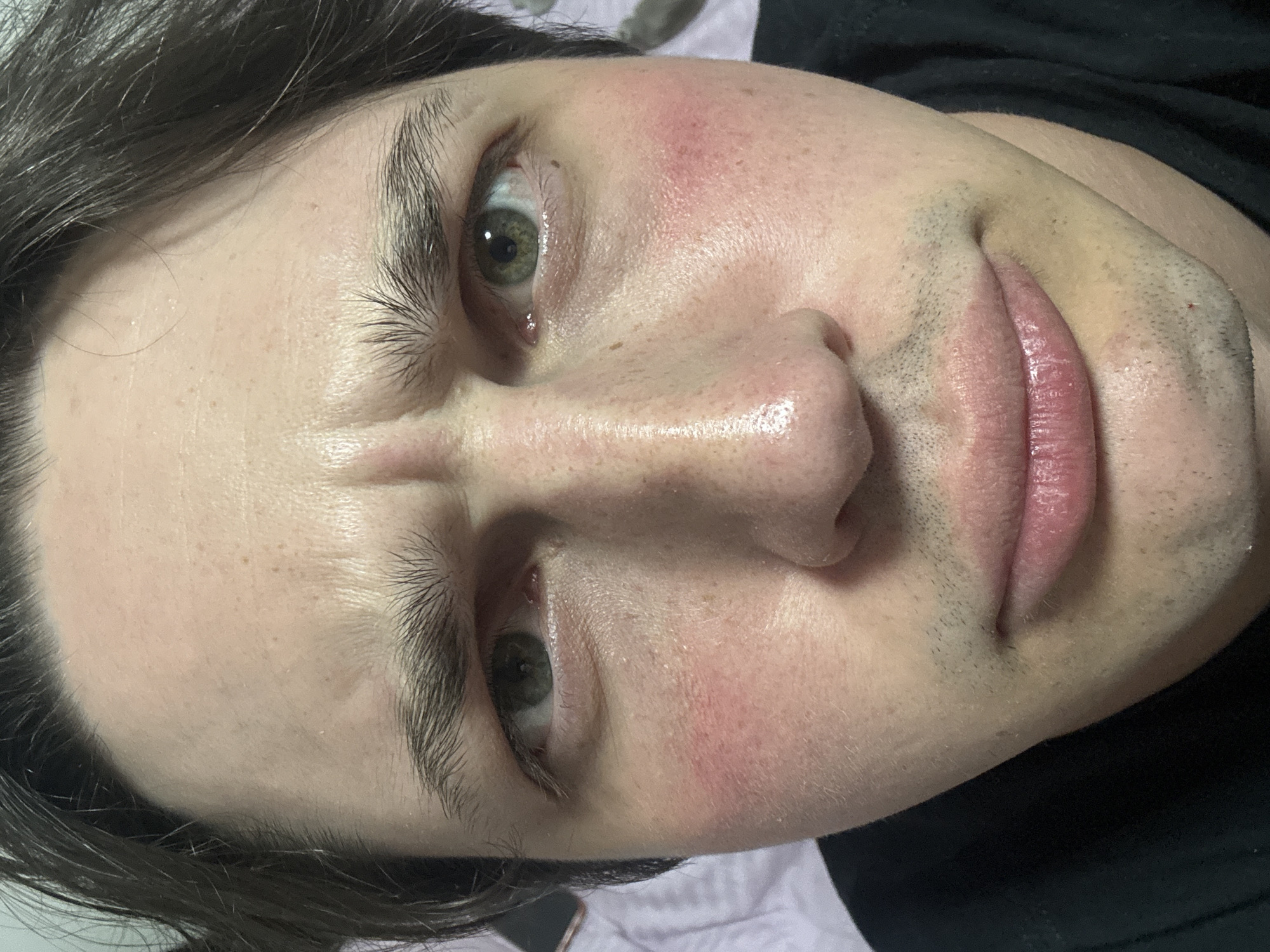 The image is a close-up, head-and-shoulders portrait of a person with fair skin, dark hair, and green eyes. The subject is looking directly at the camera with a concerned or furrowed brow. There is noticeable redness on both cheeks, which could indicate a rash, flushing, or irritation. The background is blurred and appears to be a purple or pink patterned fabric, possibly bedding. The lighting suggests an indoor setting, likely a bedroom. There is no indication of the city of Kyiv, Ukraine, or any other specific location.