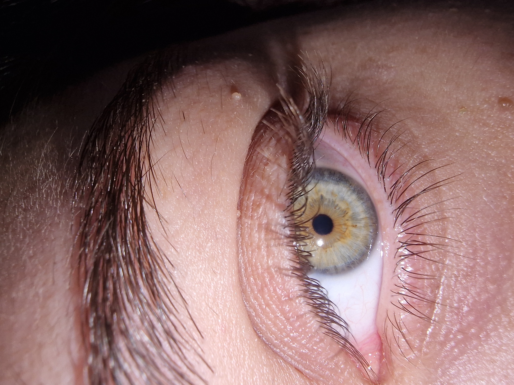 The image shows a close-up of a human eye, viewed from below and slightly to the side. The iris is multicolored, exhibiting hues of blue, green, and gold, surrounding a dark pupil. Eyelashes are visible along the upper and lower eyelids. The skin around the eye is textured, with visible pores and fine lines. A small, light-colored blemish is present on the forehead above the eyebrow. The scene provides no indication of a location or any information about the city.