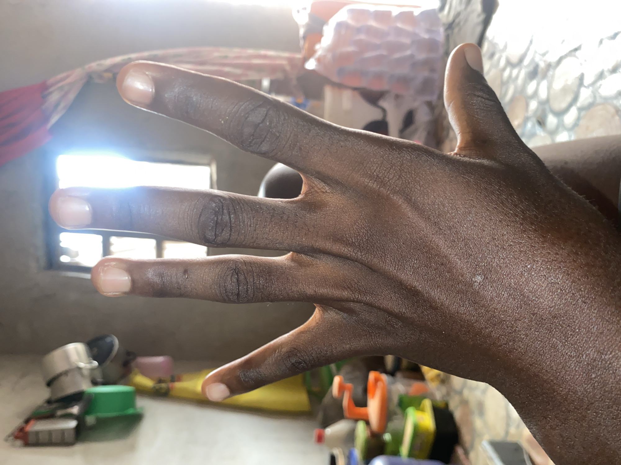 A close-up photograph shows a dark-skinned human hand with fingers splayed. The hand is positioned in the foreground, obscuring much of the background. The thumb is visible on the right side of the frame. The background contains household objects and a window providing sunlight. The location appears to be indoors. There is no clear indication of the location being in the city of Barden Yana, Nigeria.