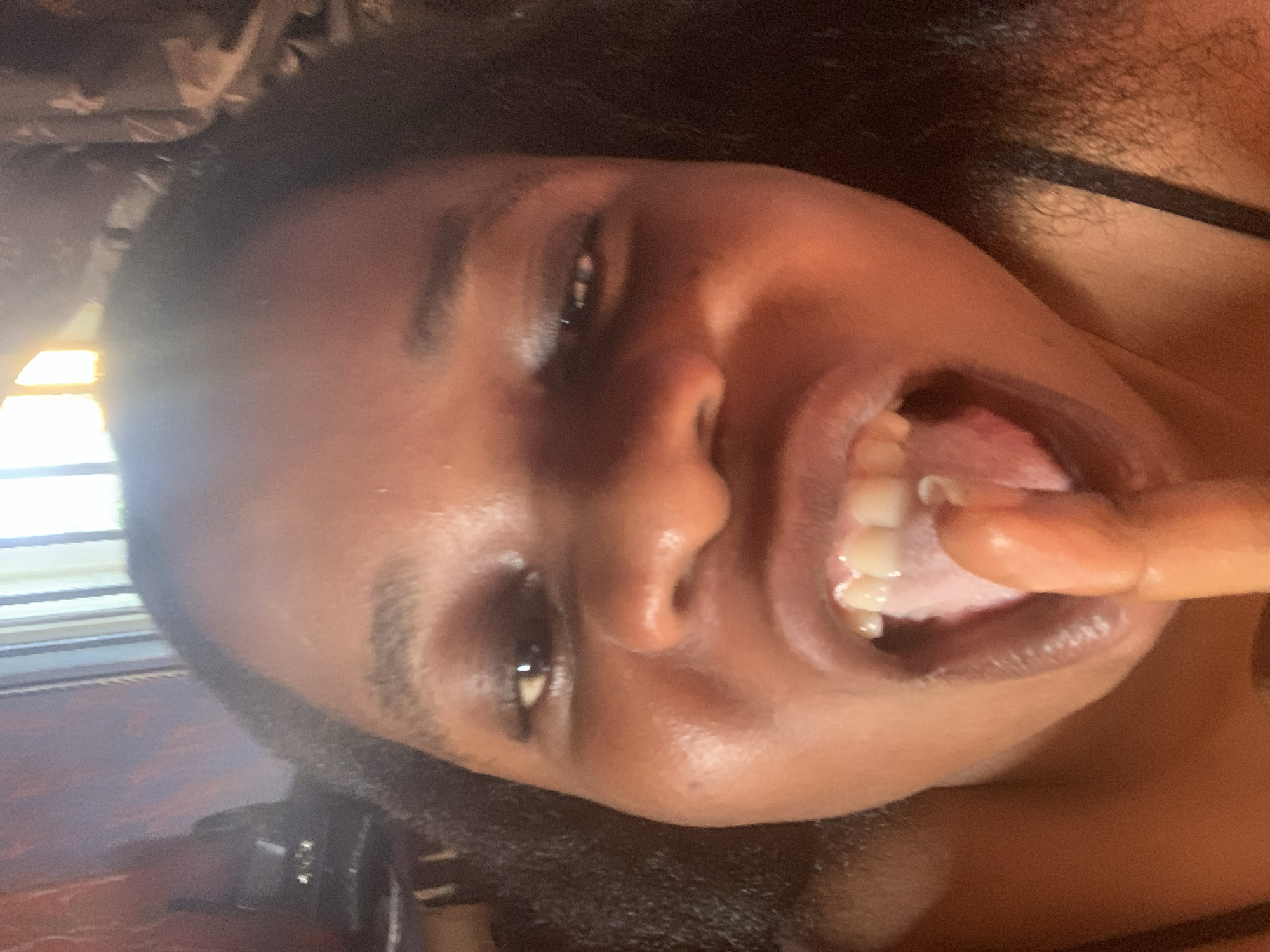 A close-up, angled view shows a person with dark skin, brown eyes, and black hair. The person's mouth is open, revealing white teeth and a pink tongue, with a finger inserted into the mouth. The background is blurry, with a window and blinds visible in the upper left corner. The image location is unknown.