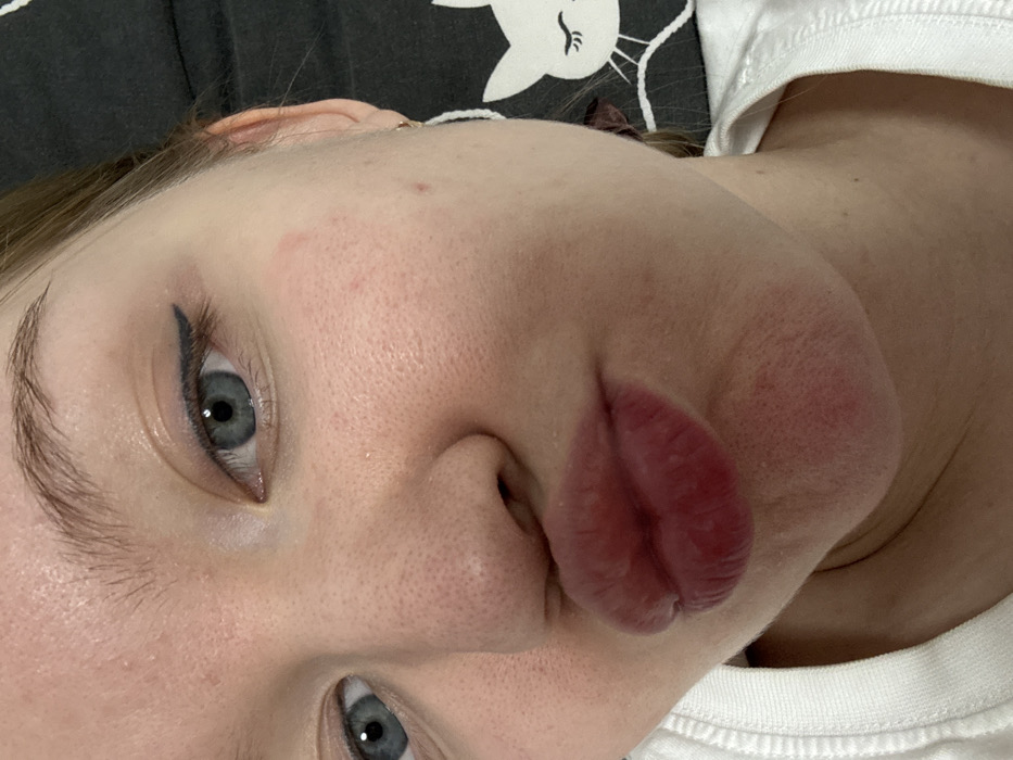A close-up, rotated image features a fair-skinned individual with blue eyes. One eye has black eyeliner. The person is pouting, with plump, red lips prominently displayed. Skin texture is visible, and a mole is near the ear. A white collar is visible on the right. The background includes a blurry black and white object with cat-like ears.