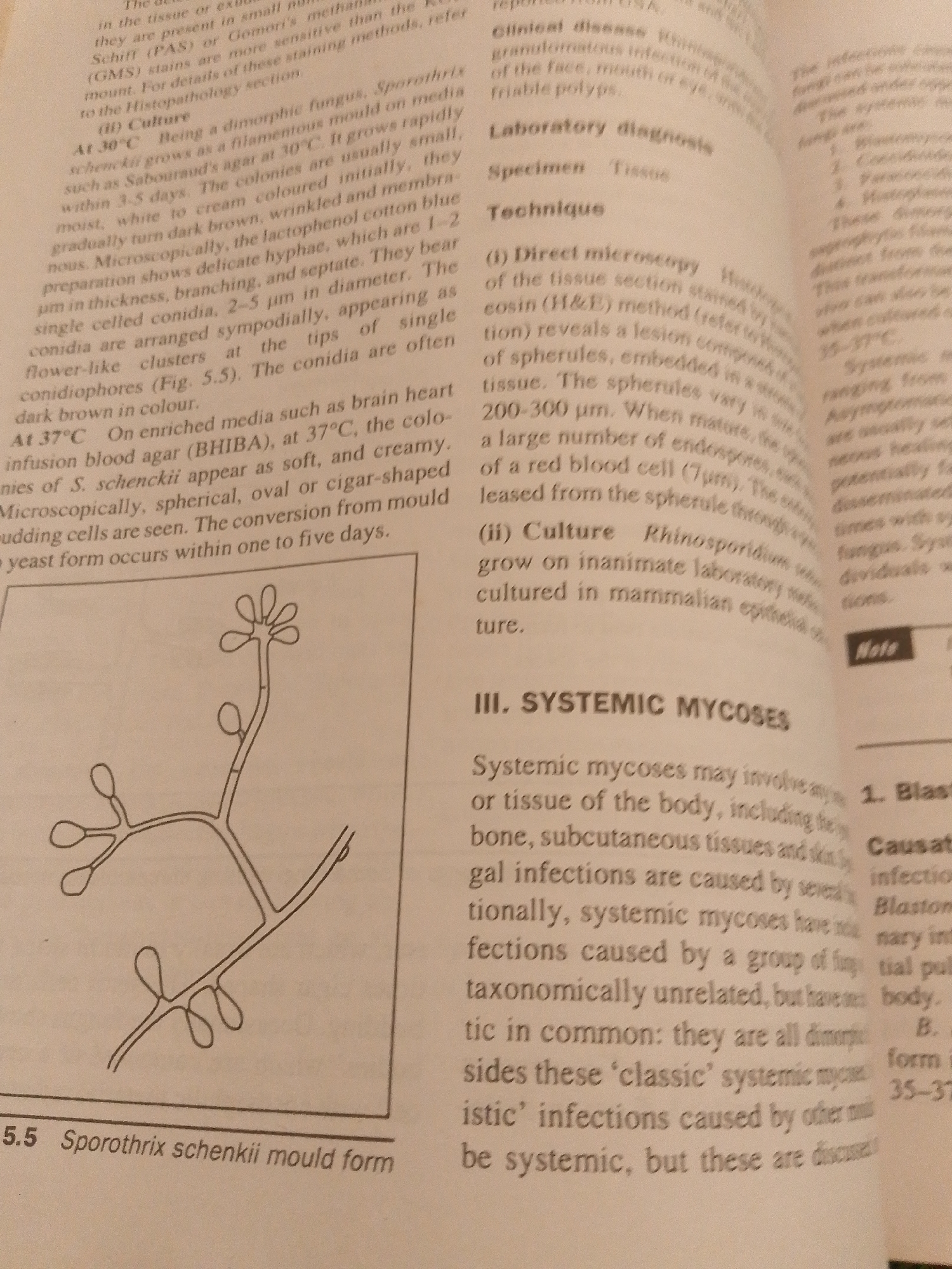 The image contains a page from a medical textbook discussing Sporothrix schenckii. The text describes the morphology and culture of the fungus, as well as systemic mycoses. A diagram shows the mold form of Sporothrix schenckii, depicting conidiophores with conidia. There is no information about Jauro Yinu, Nigeria, in the image.