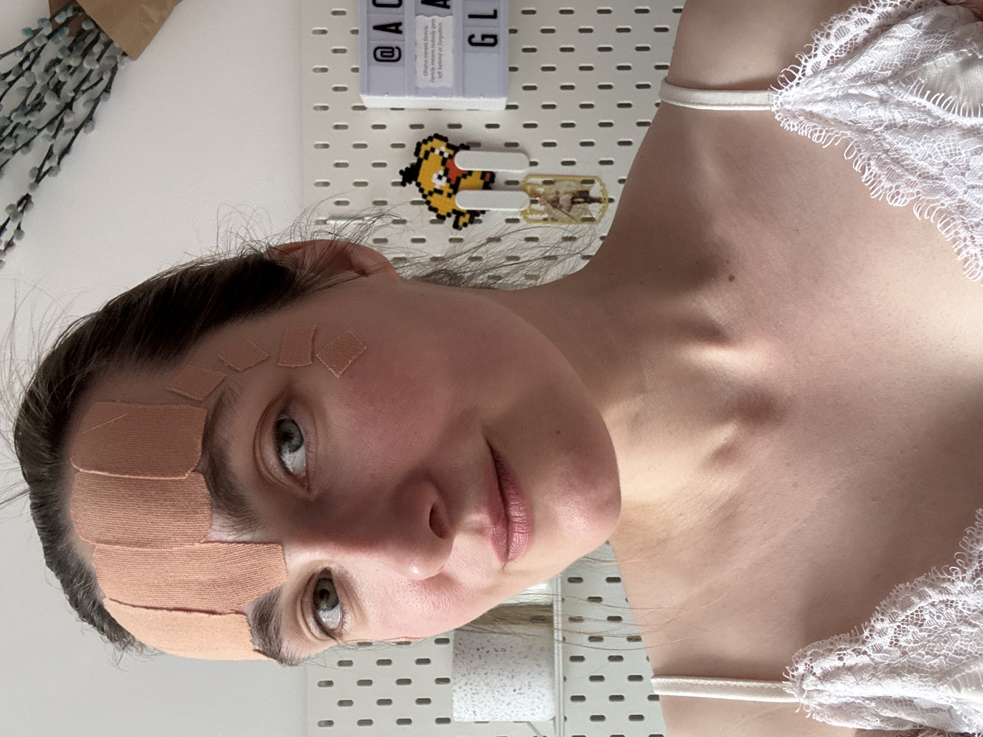 A woman is seen at close range, her face turned towards the camera. Several tan-colored adhesive bandages are applied to her forehead. She has fair skin and light-colored eyes. She is wearing a white top with lace detailing along the edges. In the background, a white pegboard is visible, on which there are some decorations: a yellow pixelated figure, a label with the word "GLA", and other items. A branch with light blue decorations is visible in the upper left corner. The image lacks information to determine it was taken in Riga, Latvia.