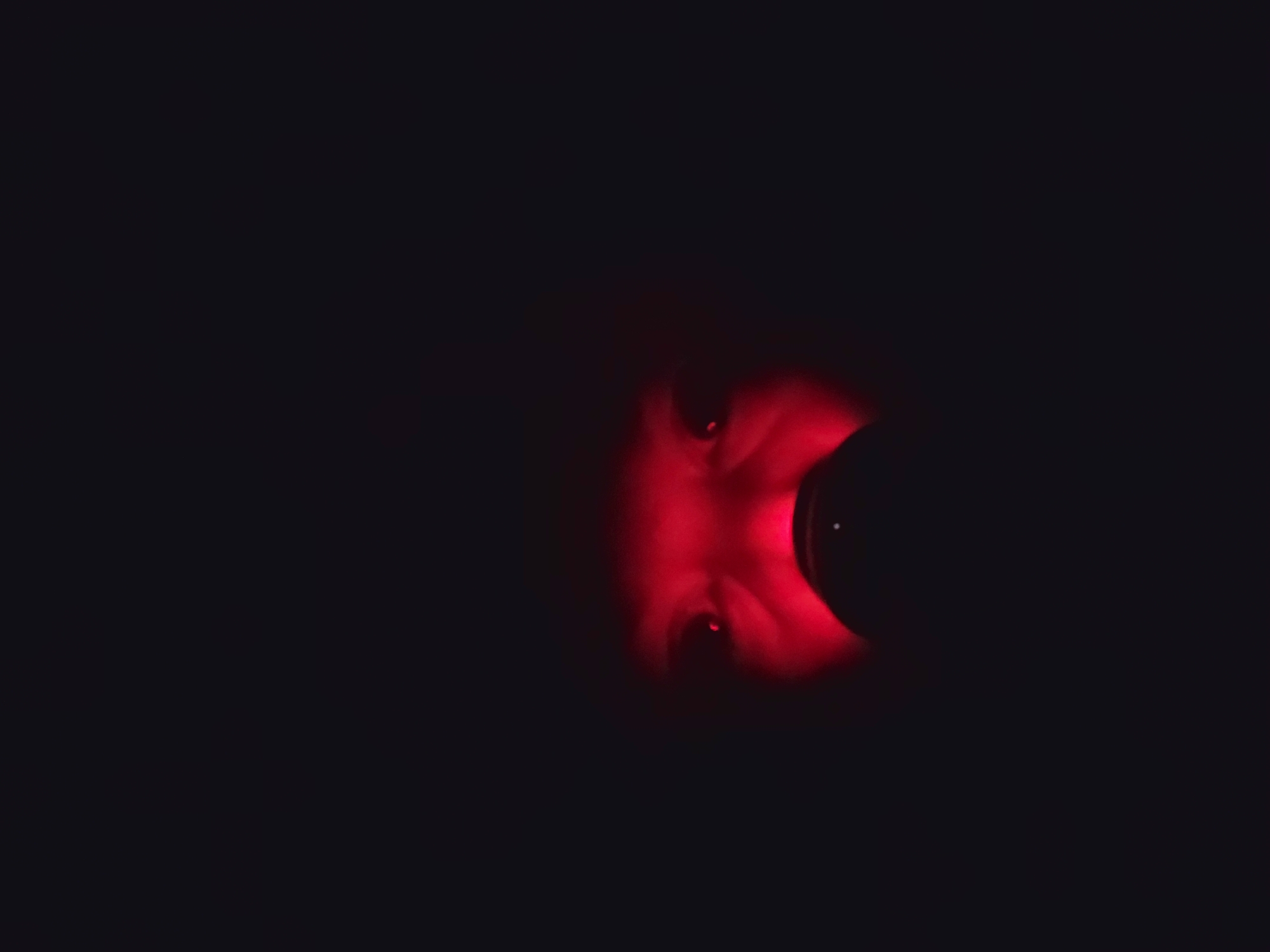 A person's face is illuminated by a red light source in an otherwise dark environment. The person is positioned to the right of the frame. A dark, cylindrical object obscures part of the face. There is no information to place the scene in Izhevsk, Russia.