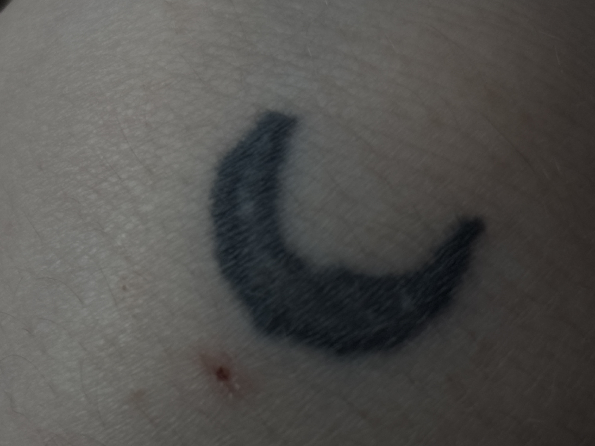 The image shows a close-up of a person's skin with a faded crescent moon tattoo. There is a small, reddish mark, possibly a scar or a healing wound, to the left of the tattoo. The skin appears textured with fine lines and possibly some light hairs. The background is out of focus and consists of more skin. There is no discernible environmental context or location within Saint Petersburg, Russia. The image is a still photograph.