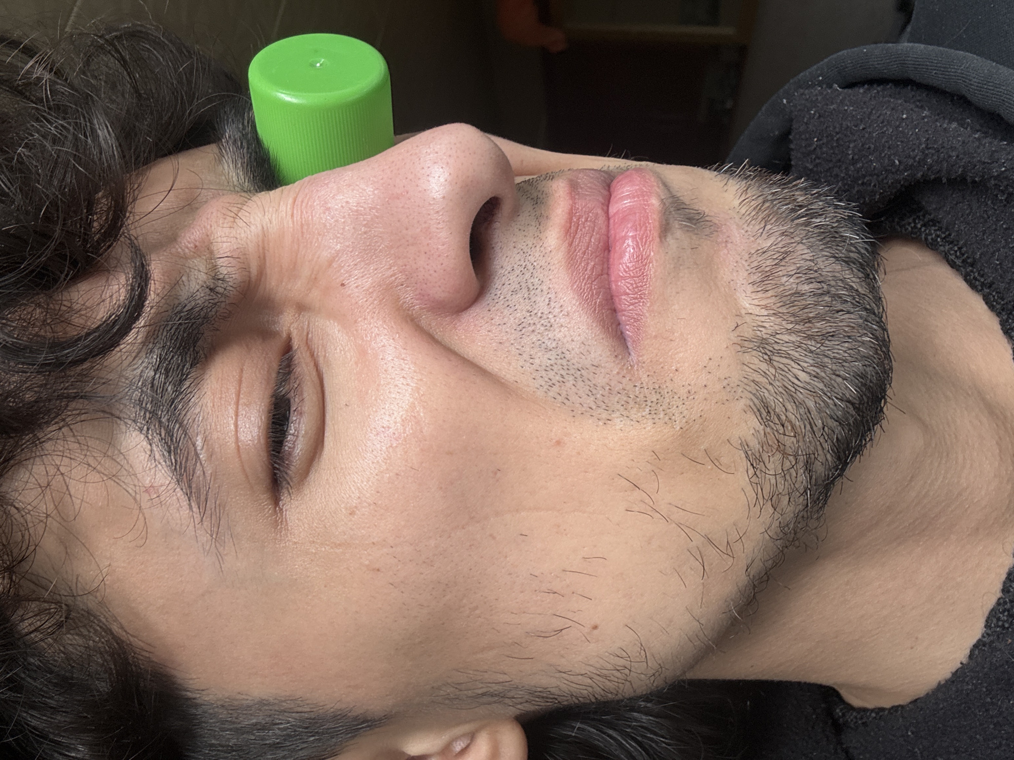 A close-up, head-and-shoulders studio portrait shows a person of indeterminate age and gender. The subject's face is turned to the right, with their left eye squeezed shut, and their mouth in a grimace. A green plastic bottle cap is pressed against the right side of their face, near the temple. The subject has dark, curly hair and a light complexion, with a patchy beard growth on their chin and jawline. The background is dark and out of focus, suggesting an indoor setting. The overall mood is one of discomfort or pain.