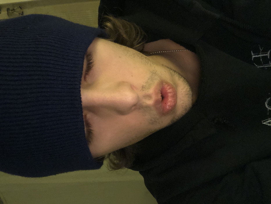 The image captures a close-up, rotated portrait of a young person, tilted approximately 90 degrees clockwise. The subject's head is angled, with their face prominent in the center.
The person is wearing a dark navy blue, ribbed knit beanie that covers the top and the left side of their head, extending down past the eyebrow on that side. Only one eye is partially visible beneath the beanie, showing a closed eyelid and a long, dark eyebrow. A prominent nose is centered on the face. Below the nose, the lips are slightly parted, forming a soft 'O' shape, as if the person is gently exhaling or about to speak. The upper lip appears somewhat textured or chapped, and a small dark mark is visible on the lower lip. Light stubble or early facial hair growth is present around the mouth, chin, and jawline.
The person is wearing a dark, likely black, hooded sweatshirt. A thin, silver-colored ball chain necklace is visible around their neck, partially covered by the hoodie. On the upper right side of the image, corresponding to the person's left shoulder/chest area, there is a distressed or ripped section on the hoodie, showing a small hole. Below this, faint white or light-colored text or a graphic design is partially visible. The letter "E" and parts of other stylized characters are discernible, suggesting a band logo or graphic. Wavy, light brown or auburn hair peeks out from under the beanie near the neck.
The background is out of focus and appears to be a plain, light greenish-yellow or beige surface, possibly a wall, indicating an indoor setting. The overall lighting is soft and even. No specific activity is depicted other than the person posing for the close-up shot. The expression appears neutral or slightly contemplative due to the gentle parting of the lips.