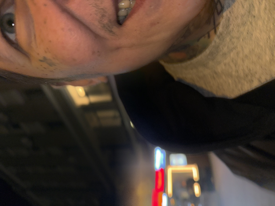 A close-up, low-light image captures the right side of an individual's face and upper torso in an urban environment at night. The subject, an adult, displays a wide smile revealing upper and lower teeth, with the right eye, featuring a blue-green iris, directed towards the viewer. Visible features include light stubble on the cheek and upper lip, and numerous dark freckles or small spots across the cheek and forehead. Colorful tattoos are present on the neck, extending from beneath the jawline. The individual wears a light gray crew-neck t-shirt beneath a dark, potentially hooded, outer garment.
The background is out of focus. To the left, blurred artificial light sources appear as rectangular and irregular shapes in red, blue, and yellow-orange, consistent with commercial signage or storefronts. To the right and upper background, a dark building facade is visible, featuring at least two illuminated windows casting a warm yellow light. The scene's overall lighting indicates nighttime conditions, illuminated by artificial street and building lights. The specific location within Moscow, Russia, is not discernible from the visual information provided.