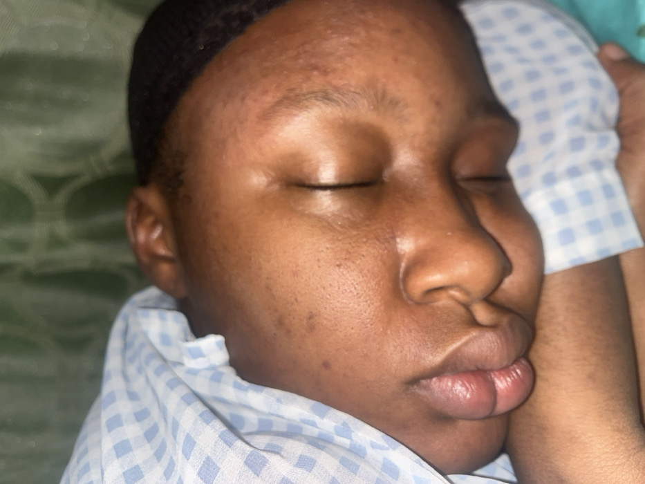 A close-up photograph depicts a Black woman sleeping peacefully. Her eyes are closed, and her head rests on a pillow with a blue and white checkered pattern. The light softly illuminates her face, revealing smooth skin with subtle imperfections. Her lips are slightly parted, suggesting deep relaxation. Her hair is dark and close-cropped. The overall impression is one of serenity and rest.
