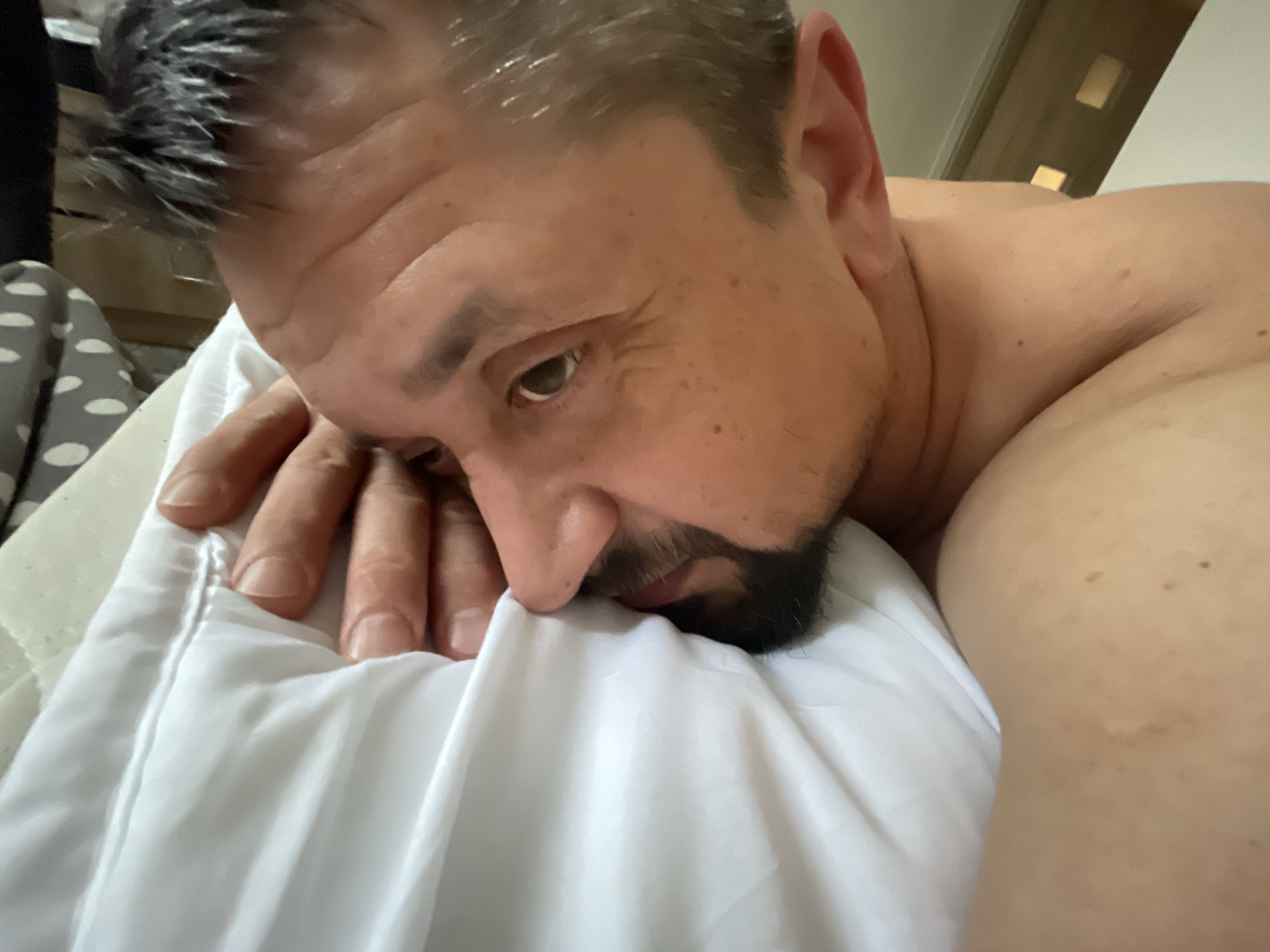 A male subject is depicted in a close-up, angled view, lying on a white pillow indoors, identified as a bedroom setting in the city of Unknown, Unknown. The individual, an adult male with short, dark hair containing grey strands, dark beard, and mustache, rests his head on the pillow. His left hand is positioned on the pillow near his face. The visible left eye is open and directed towards the lower right quadrant of the frame. The subject's upper torso, including a shoulder and portion of the upper back, is visible and appears bare. Skin exhibits multiple scattered small moles and a faint scar-like mark on the visible shoulder. The immediate background on the left reveals a grey and white polka-dotted fabric, while the upper right background shows a blurred, light-toned surface with horizontal, lighter rectangular features, consistent with room furnishings.