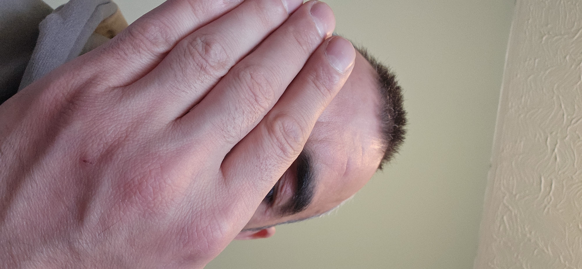 The image presents a close-up, low-angle perspective of a person covering part of their face with their right hand. The hand dominates the foreground, with fingers extending upwards, obscuring the eyes and the bridge of the nose. Only the person's forehead, a dark eyebrow, a sliver of an eye, and the hairline with short, dark hair are visible above the hand. The skin on the hand and visible face appears fair, with discernible texture and fine hairs on the hand. A small, reddish mark is present on the back of the hand. The background is a plain, light-colored surface, likely an indoor wall or ceiling, with a distinctly textured section on the right side, suggesting decorative wallpaper or a stucco finish. The lighting is soft and even, consistent with an indoor environment. The gesture of covering the face conveys a sense of shyness, weariness, privacy, or an effort to shield the eyes from light. No text is visible in the image. The scene is set in Norwich, United Kingdom.