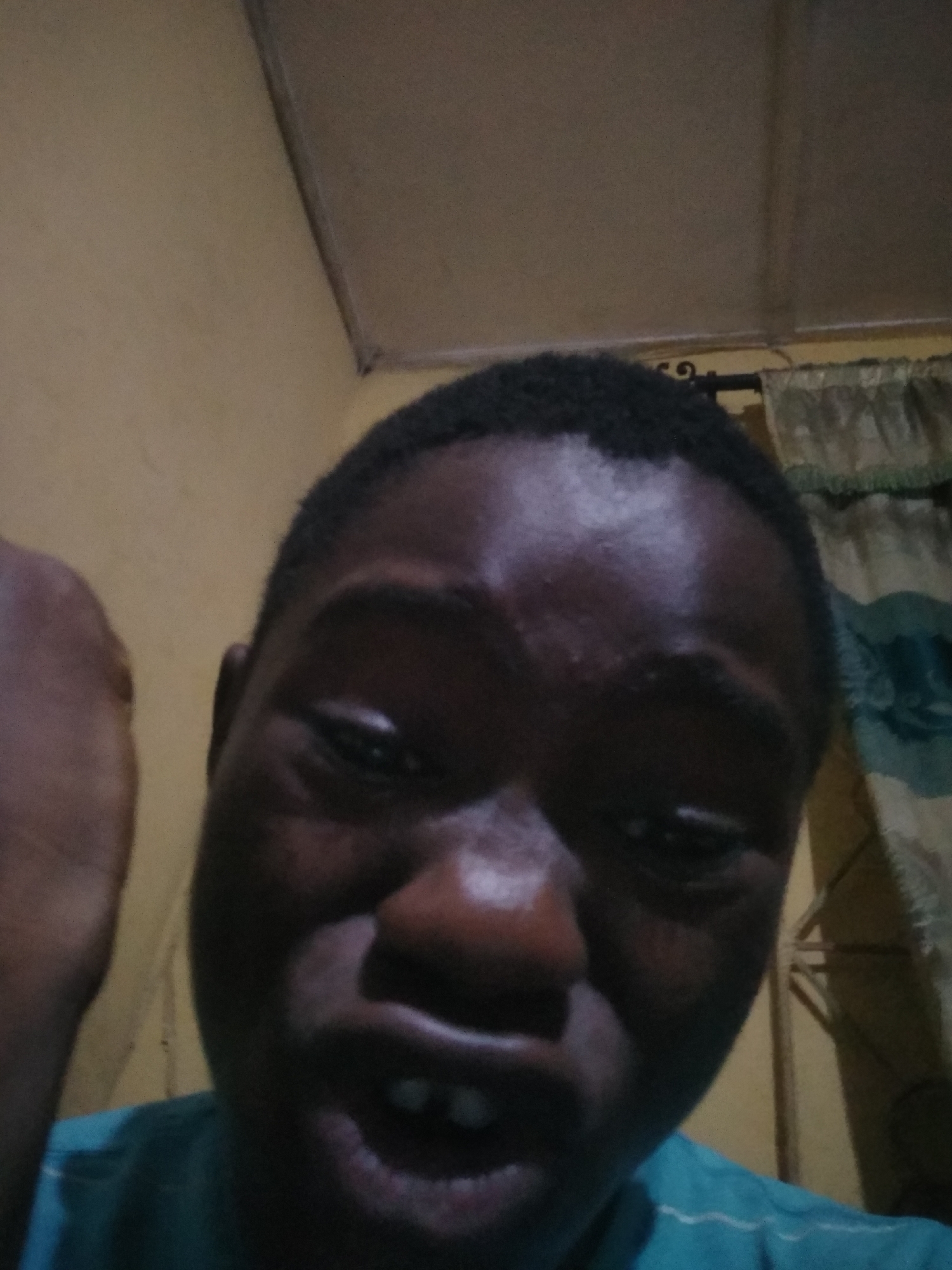 A close-up selfie of a dark-skinned young man with short, dark hair. His face is the primary focus, showing details of his eyes, nose, mouth with visible teeth, and forehead. He is wearing a blue shirt.
The background is slightly out of focus, showing a yellow wall and a window covered with a patterned curtain. The location is identified as Shangisha, Nigeria.